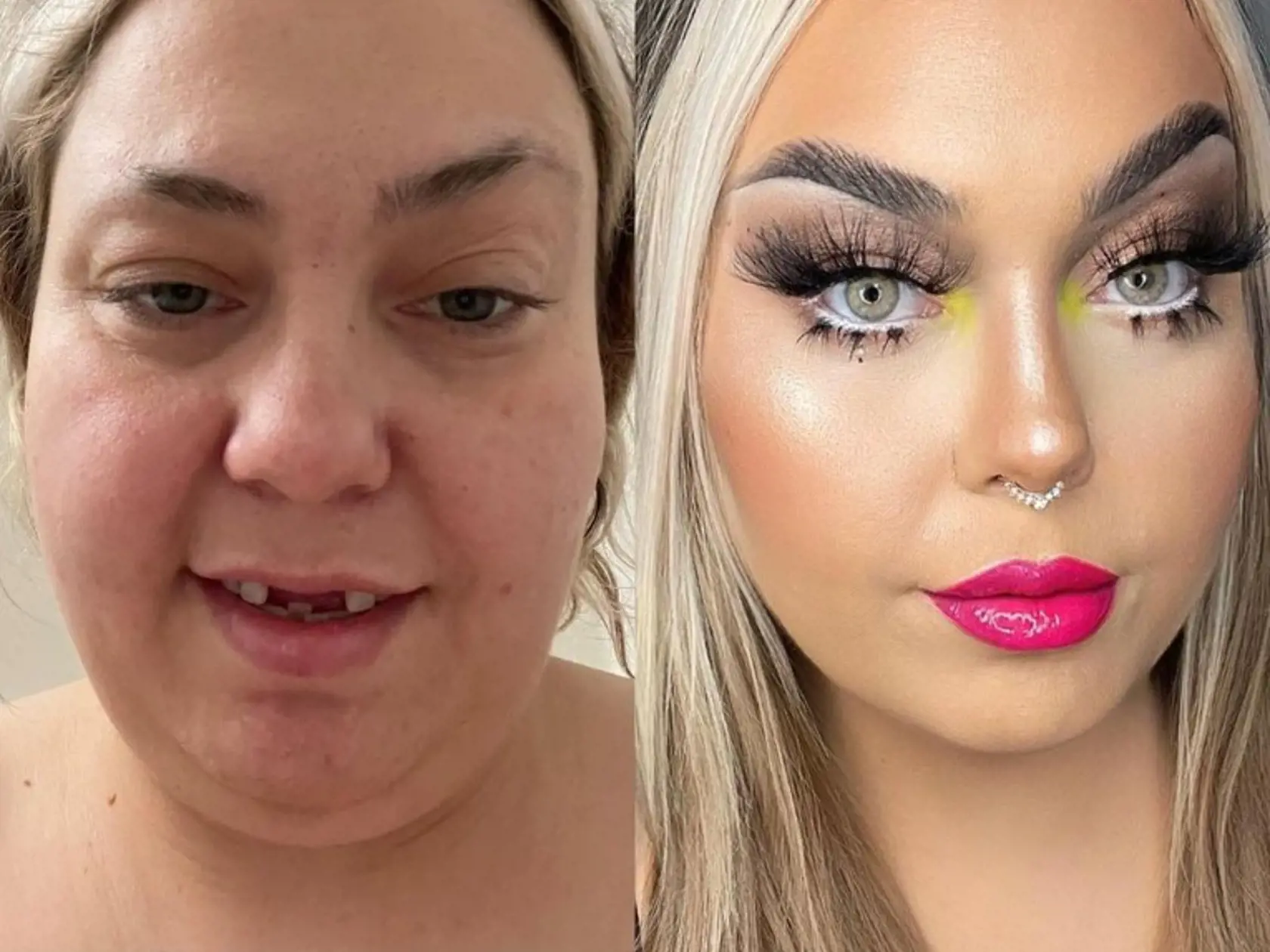Sarah sa pri tom na sociálnej sieti na nič nehrá a ľuďom vo videách ukazuje svoju pravú tvár pred premenami. Mladej žene pri tom chýbajú predné zuby a jej pleť má ďaleko od dokonalosti. Práve na svojom vzhľade si však postavila svoj úspech.
