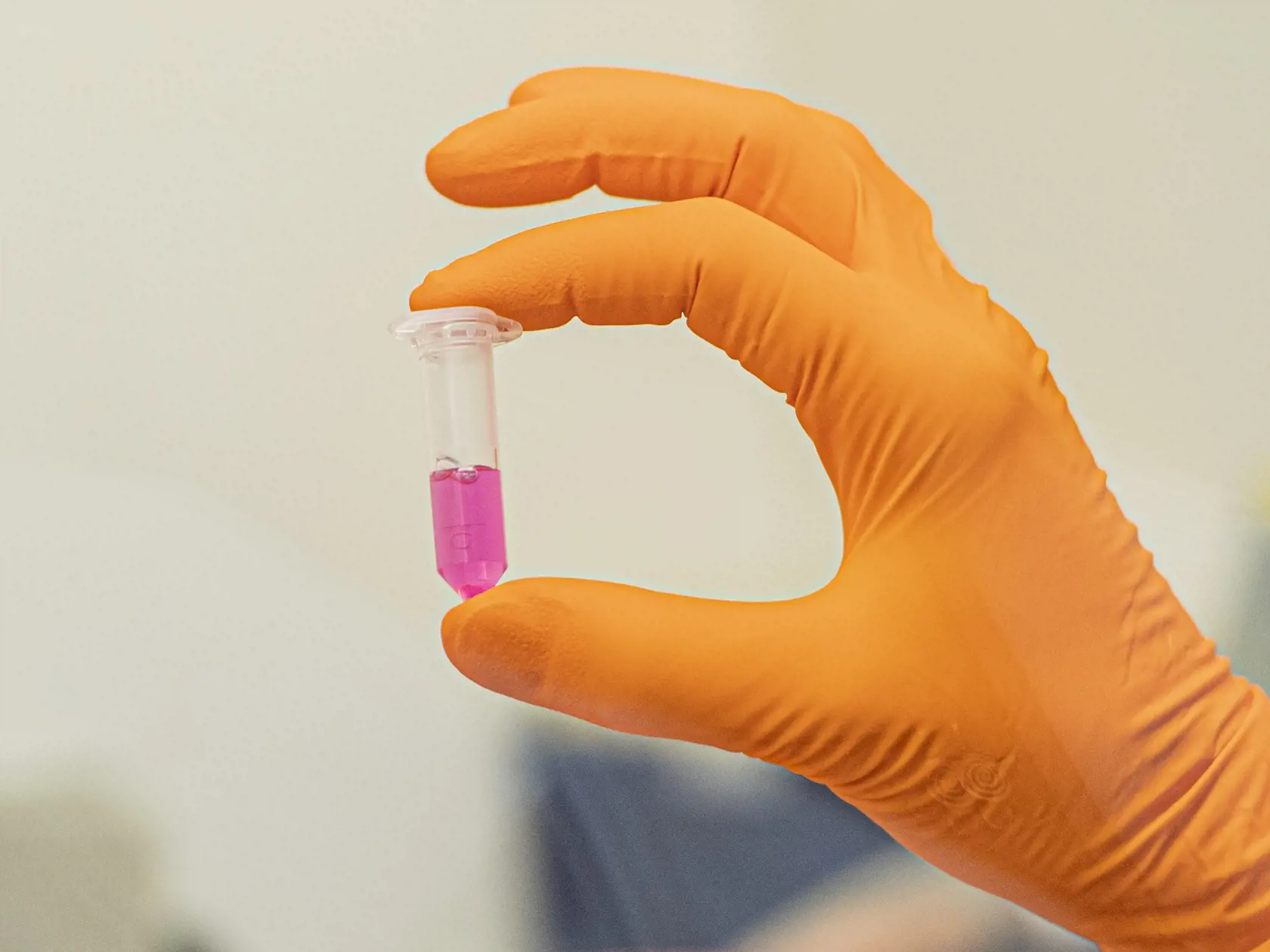 S plným nasadením kapacít súkromných a štátnych laboratórií odhaduje štát v priebehu týždňov počet testovaných pacientov až na 4000 denne.