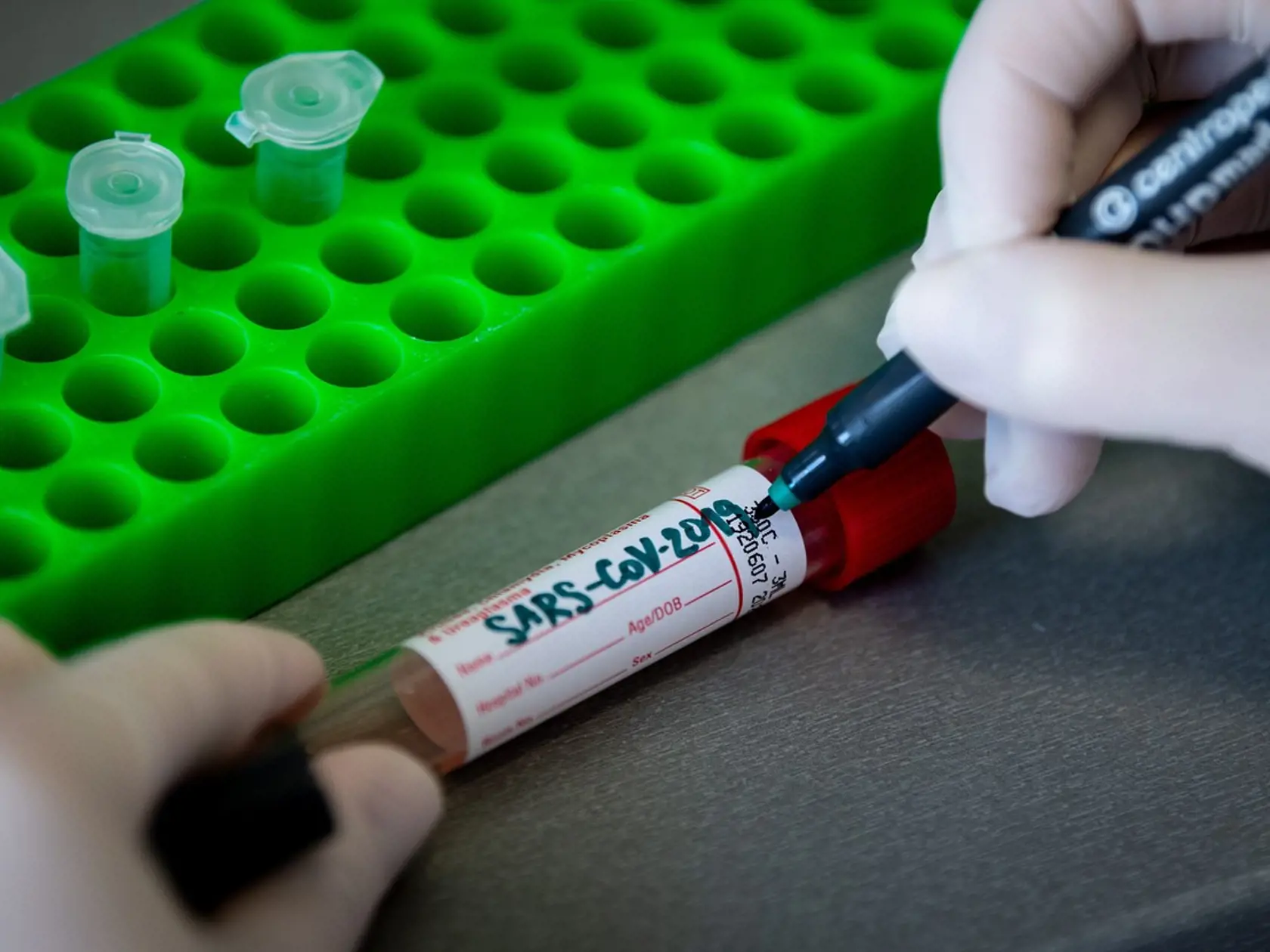 S plným nasadením kapacít súkromných a štátnych laboratórií odhaduje štát v priebehu týždňov počet testovaných pacientov až na 4000 denne.