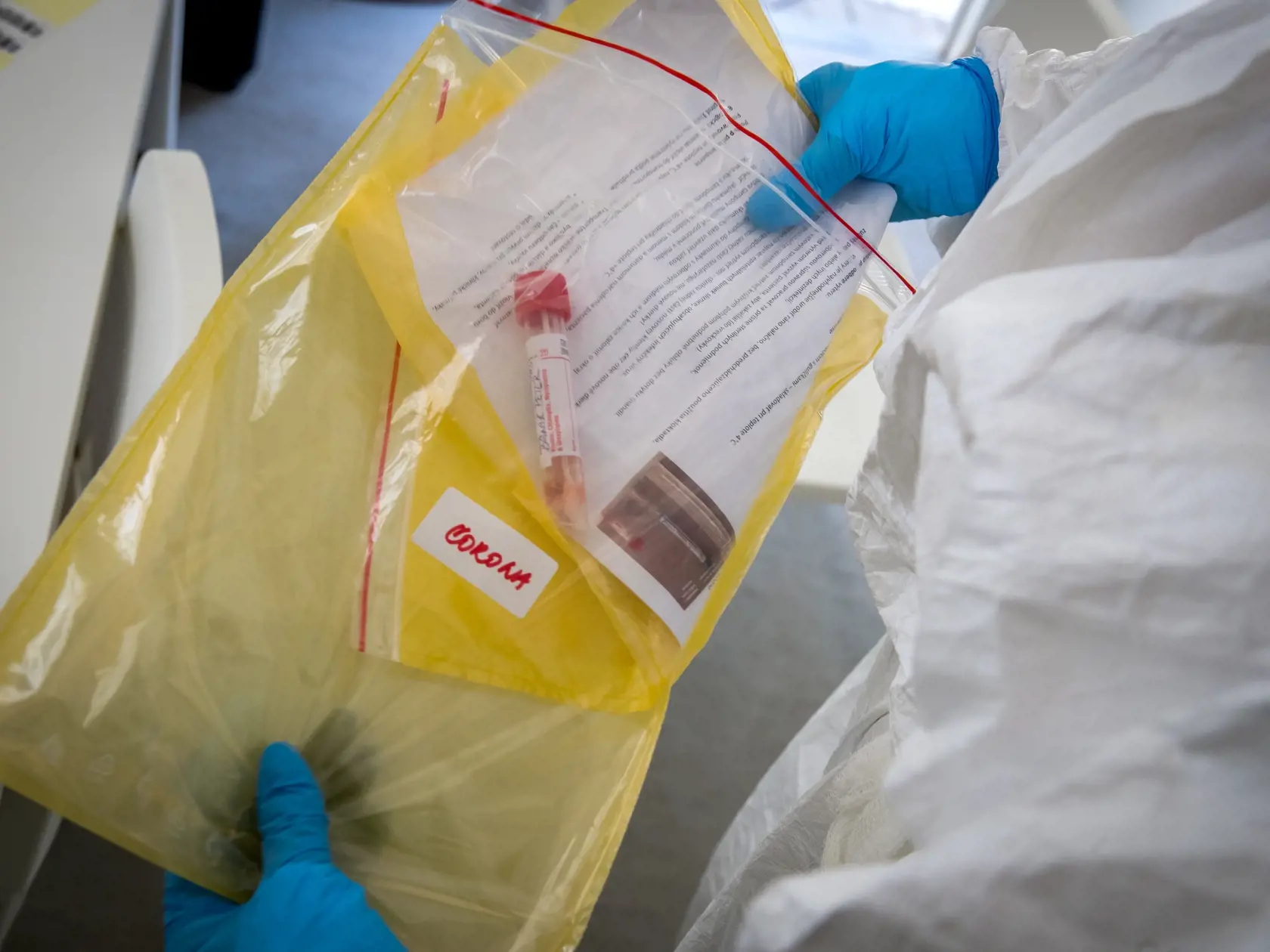 S plným nasadením kapacít súkromných a štátnych laboratórií odhaduje štát v priebehu týždňov počet testovaných pacientov až na 4000 denne.