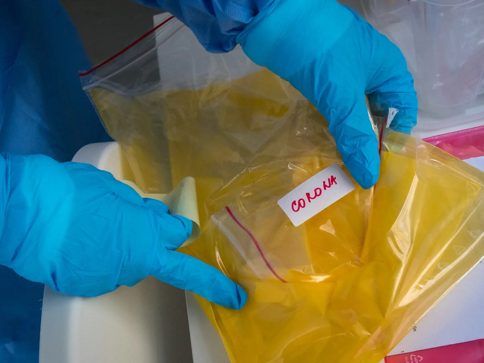 S plným nasadením kapacít súkromných a štátnych laboratórií odhaduje štát v priebehu týždňov počet testovaných pacientov až na 4000 denne.