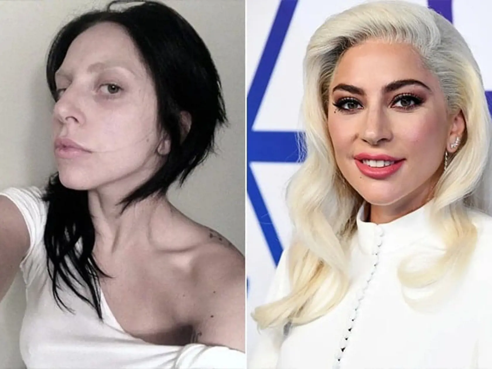 Mejkap Lady Gagy je dôkazom, že aj výraznejšie črty dokáže dobrá maskérka skryť. Gagin nos hneď pôsobí menšie!