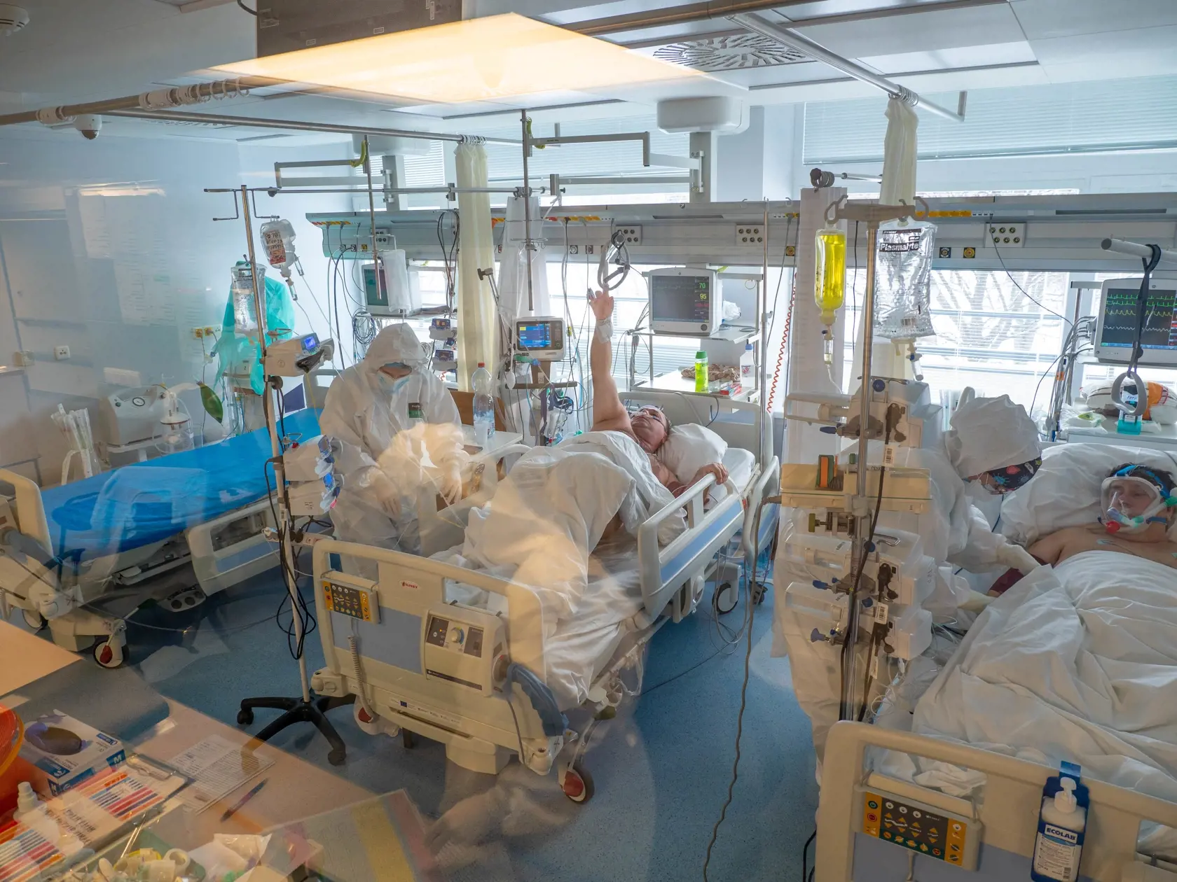 NA KYSLÍKU Maska alebo vysokoprietokový kyslík sú pre pacienta menej zaťažujúce ako uspanie a pľúcna ventilácia.