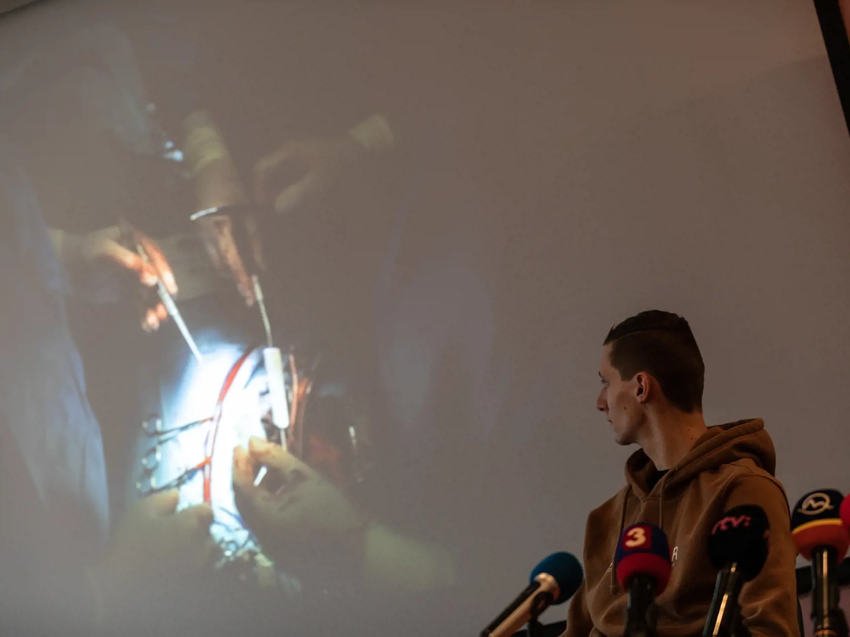 Prvú implantáciu umelého srdca na Slovensku vykonali 1. novembra 2017 v Národnom ústave srdcových a cievnych chorôb v Bratislave, bola to prvá operácia tohto typu v krajinách V4.