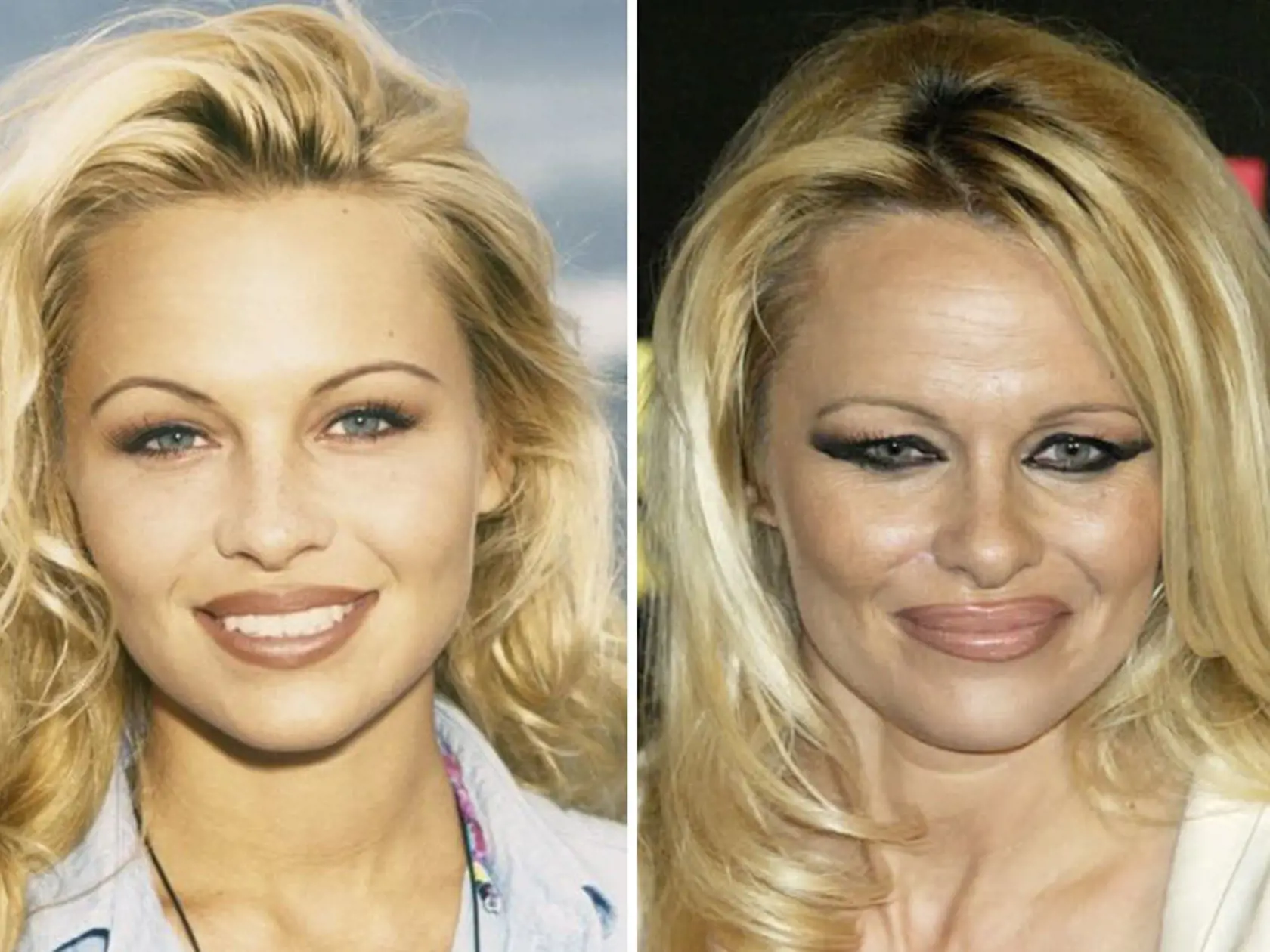 Pamela Anderson. Najznámejšia ženská herečka seriálu a playmate pokračovala v kariére B-čkovými akčnými sériami. V minulosti bola hviezdou večierkov, dnes sa v súkromí venuje najmä synom a priateľovi Adilovi Ramimu.