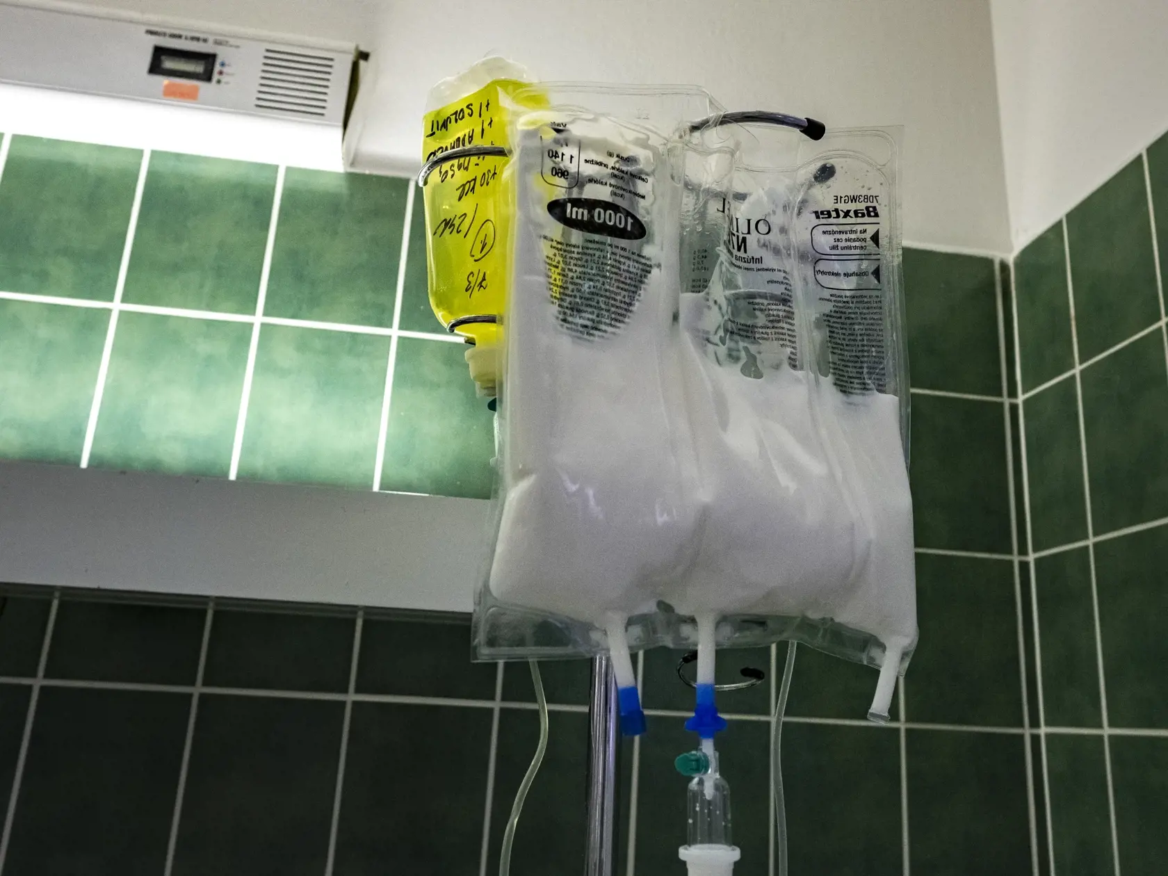 Pacienti dostávajú výživu vo forme infúzie, v nutričnom koktejli majú všetky potrebné živiny.