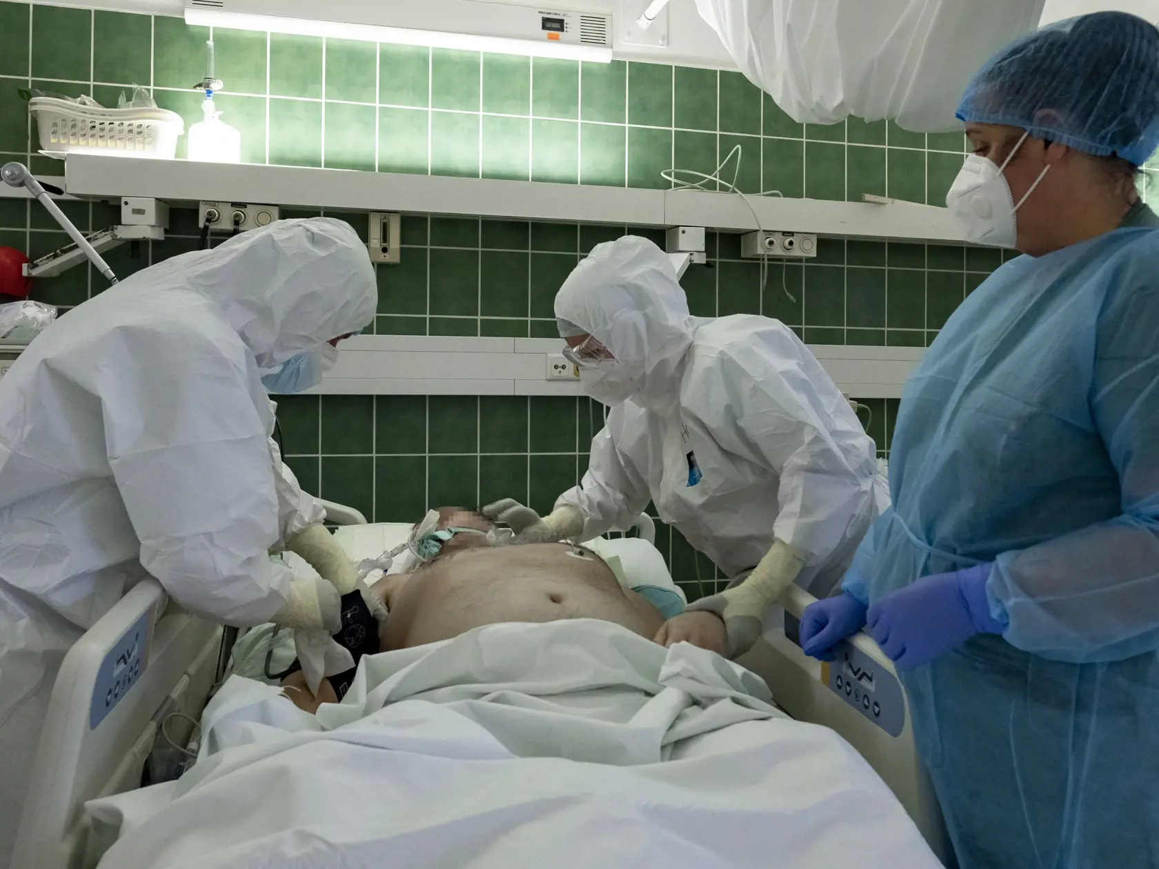 Vekový priemer pacientov, ktorí skončia na ventilácii, sa posúva smerom nadol.