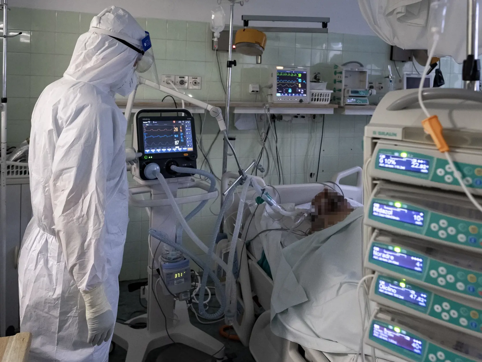 Lekár kontroluje stav pacienta na umelej pľúcnej ventilácii.