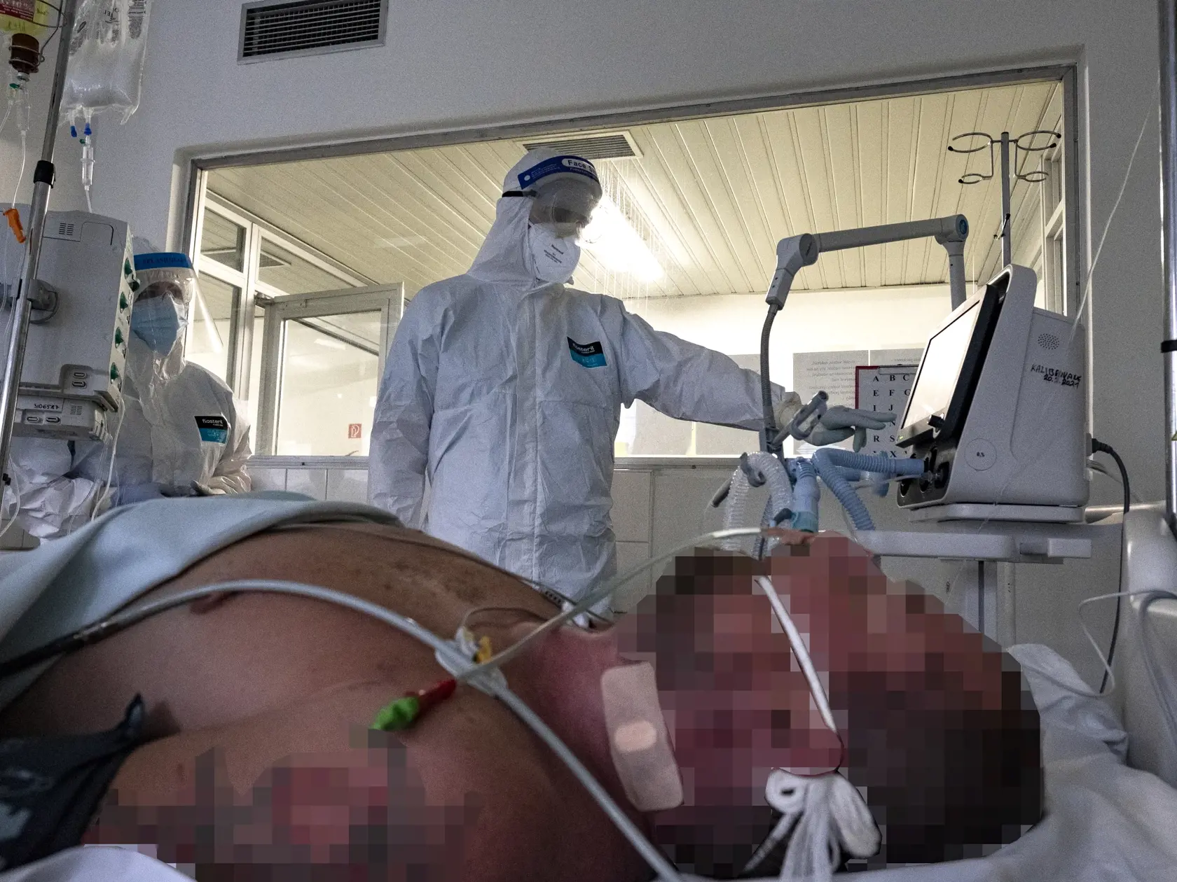 V nemocnici končia čoraz mladší ľudia, dokonca aj takí, ktorí sa predtým na nič neliečili.