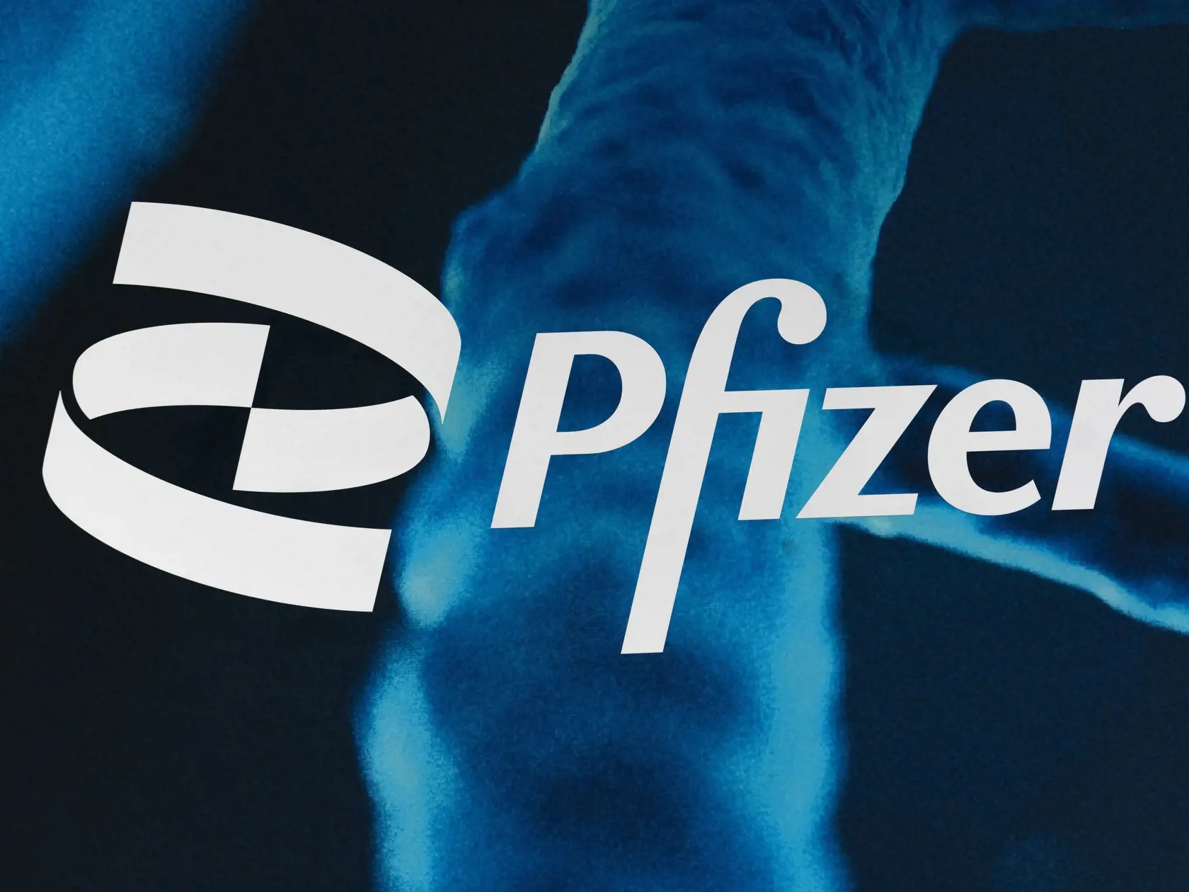 Americká spoločnosť Pfizer vo štvrtok oznámila, že za 5,3 miliardy dolárov dodá americkej vláde svoj experimentálny liek proti ochoreniu COVID-19 Paxlovid v množstve použiteľnom na 10 miliónov liečebných cyklov.