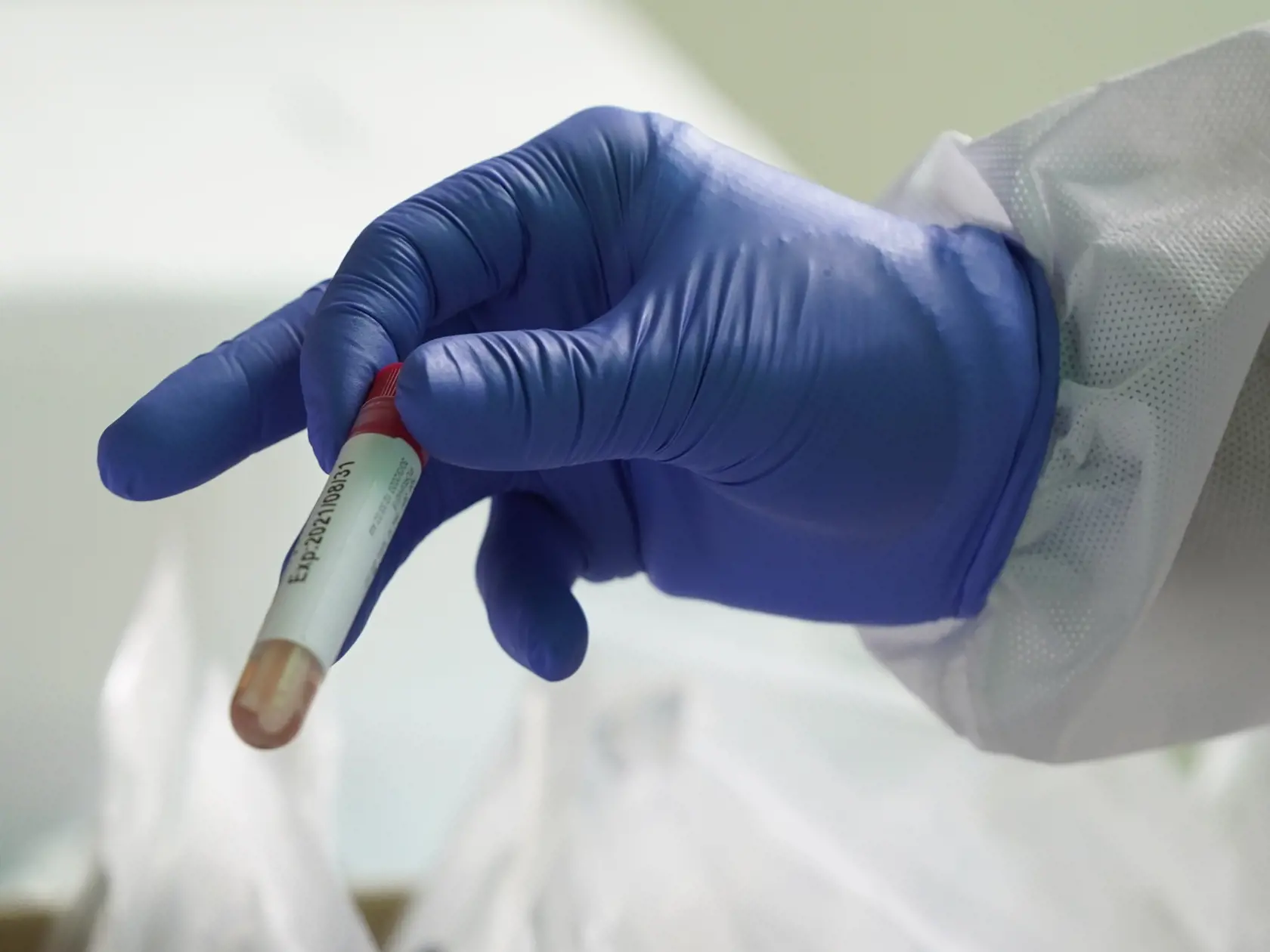 MIK 5 Kuala Lumpur - Zdravotníík drží testovaciu banku na testy na koronavírus v nemocnici  KPJ Damansara Specialist Hospital v Petaling Jaya v Malajzii 30. marca 2020. FOTO TASR/AP


A health worker holds a testing tube after conducing at a drive-through COVID-19 test at KPJ Damansara Specialist Hospital, in Petaling Jaya, Malaysia, Monday, March 30, 2020. The Malaysian government issued a restricted movement order to the public till April 14, to help curb the spread of the new coronavirus. The