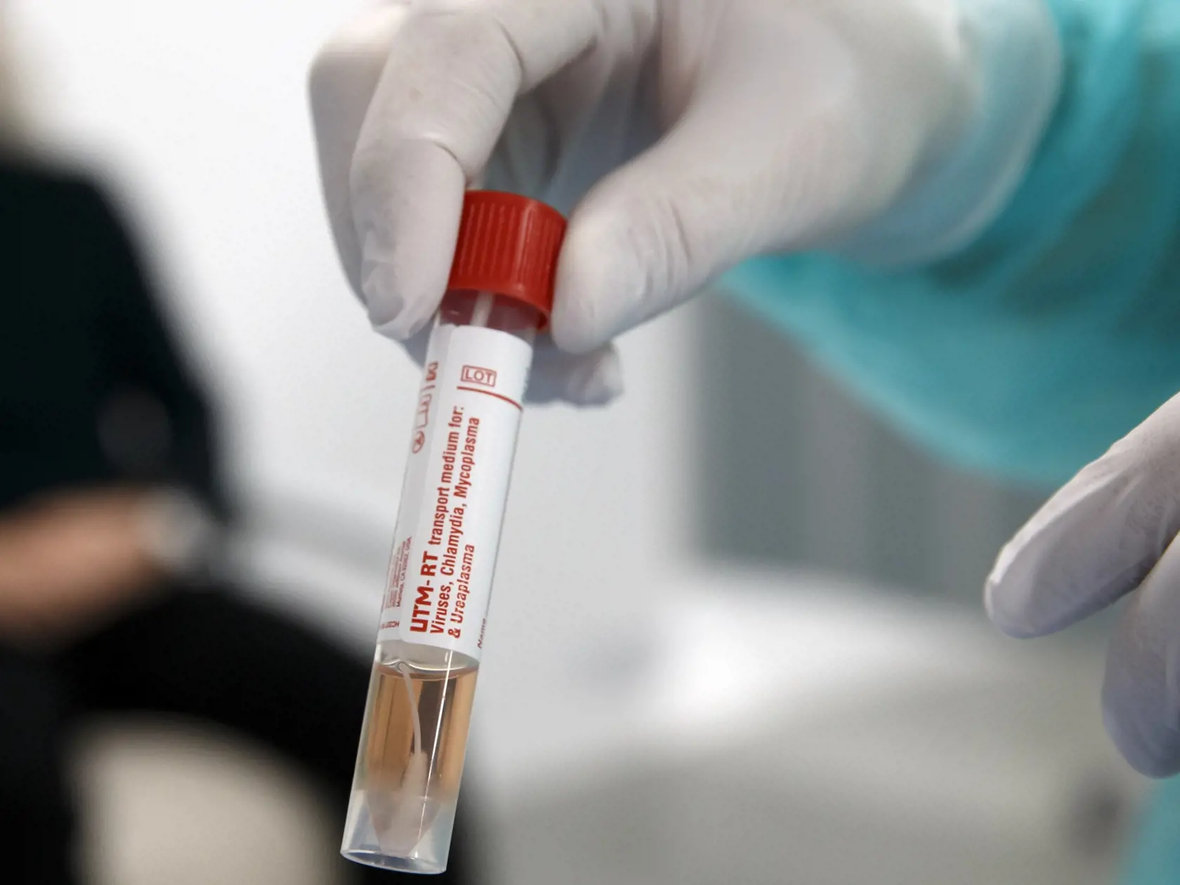 MIK 19 Ženeva - Doktor Julien Salamun pripravuje vzorku od osoby podozrivej z infekcie koronavírusom COVID-19, SARS-CoV2, vo Fakultnej nemocnici v Ženeve, Švajčiarsko, 10. marca 2020. FOTO TASR/AP

Doctor Julien Salamun prepares a sample from a person suspected of being infected with coronavirus COVID-19, SARS-CoV2, at the University Hospital in Geneva, Switzerland, Tuesday, March 10, 2020. For most people, the new coronavirus causes only mild or moderate symptoms, such as fever and cough. For s