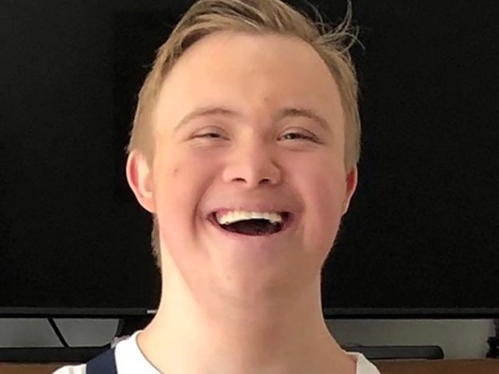 Mexická herečka sa preslávila najmä vďaka telenovele Esmeralda. Roky hovorí o tom, aké je to vychovávať syna s genetickým ochorením.