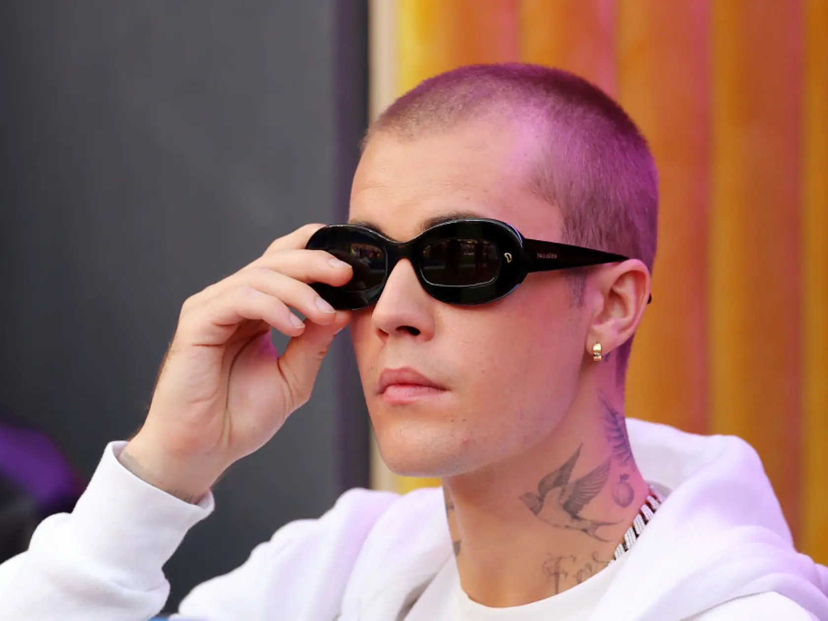 Plastický chirurg Dr. Gary Linkov naznačil, že spevák Justin Bieber podstúpil transplantáciu vlasov. Na starých fotkách mu totiž vidieť „kúty“.