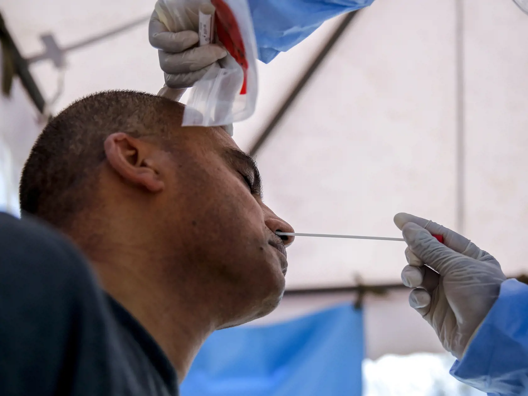 KK22 Nairobi - Laboratórna technička odoberá pacientovi vzorky na ochorenie Covid-19 v laboratóriu 5. apríla 2020 v Nairobi. Spoločnosť, ktorá ponúka testy na Covid-19 pre pacientov s odporúčaním od lekára, predtým musela posielať vzorky do Juhoafrickej republiky, ale v súčasnosti dokončuje testovanie v Keni. FOTO TASR/AP
IIn this photo taken Sunday, April 5, 2020, a laboratory technician takes a nasal swab from a patient seeking a test for the new coronavirus that causes COVID-19, at the Pathol