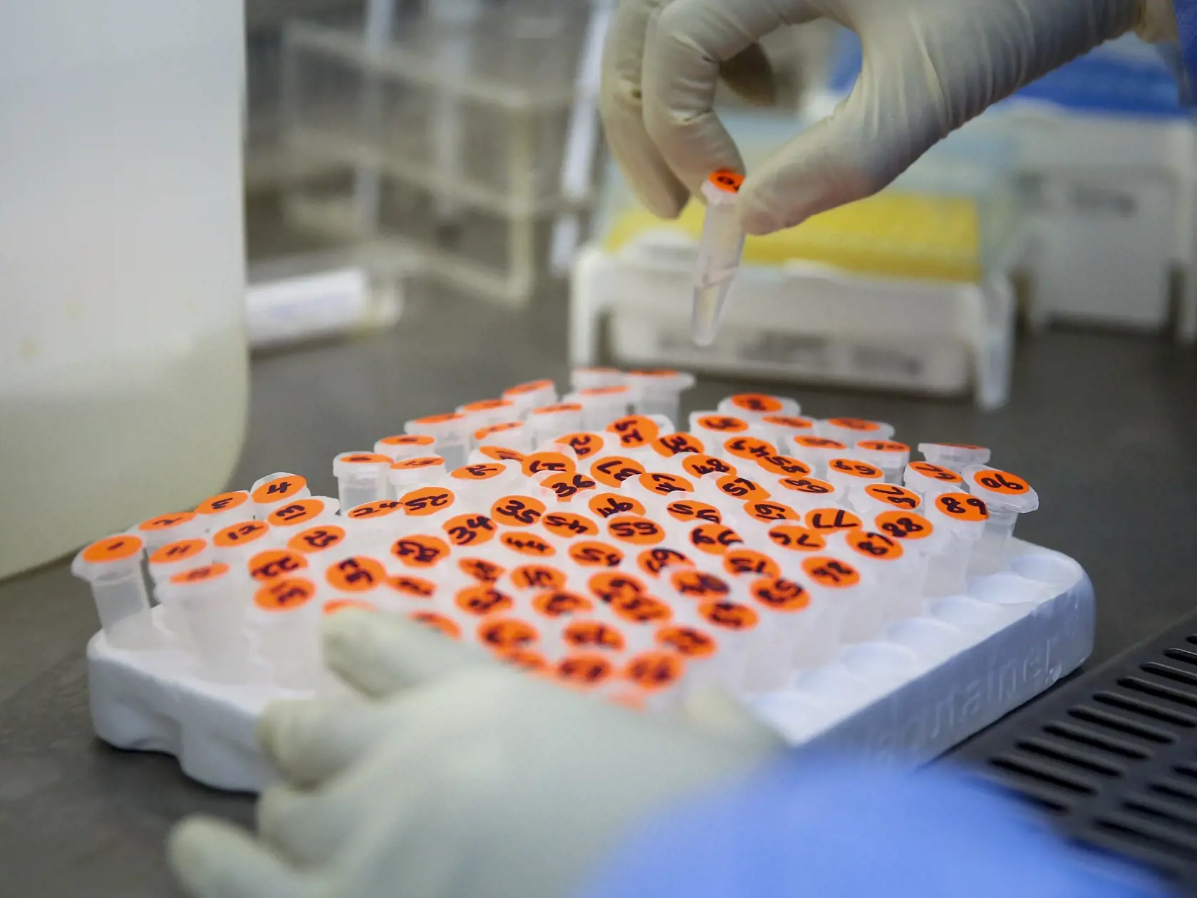 KK24 Nairobi - Laboratórna technička manipuluje so skúmavkami, ktoré obsahujú vzorky pacientov podozrivých na ochorenie Covid-19 v laboratóriu 5. apríla 2020 v Nairobi. Spoločnosť, ktorá ponúka testy na Covid-19 pre pacientov s odporúčaním od lekára, predtým musela posielať vzorky do Juhoafrickej republiky, ale v súčasnosti dokončuje testovanie v Keni. FOTO TASR/AP
In this photo taken Sunday, April 5, 2020, a laboratory technician handles micro centrifuge tubes containing patient samples to be t
