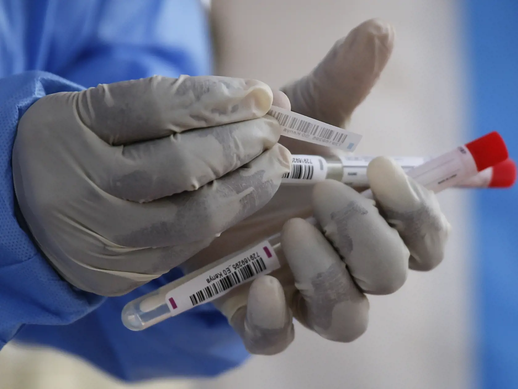 KK21 Nairobi - Laboratórna technička pripravuje materiál na testovanie na ochorenie Covid-19 v laboratóriu 5. apríla 2020 v Nairobi. Spoločnosť, ktorá ponúka testy na Covid-19 pre pacientov s odporúčaním od lekára, predtým musela posielať vzorky do Juhoafrickej republiky, ale v súčasnosti dokončuje testovanie v Keni. FOTO TASR/AP
In this photo taken Sunday, April 5, 2020, laboratory technician Irene Ooko prepares nasal swabs to be tested for the new coronavirus that causes COVID-19, at the Patho