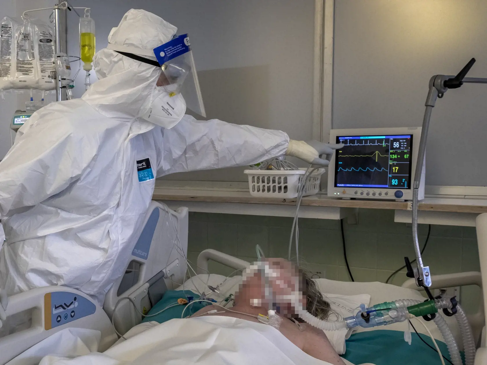 Situácia na anesteziologicko-resuscitačnom oddelení nemocnice svätého Cyrila a Metoda v Bratislave si vyžiadala zriadenie špeciálnej sekcie, kde sa nepretržite starajú o pacientov nakazených koronavírusom Covid - 19. 