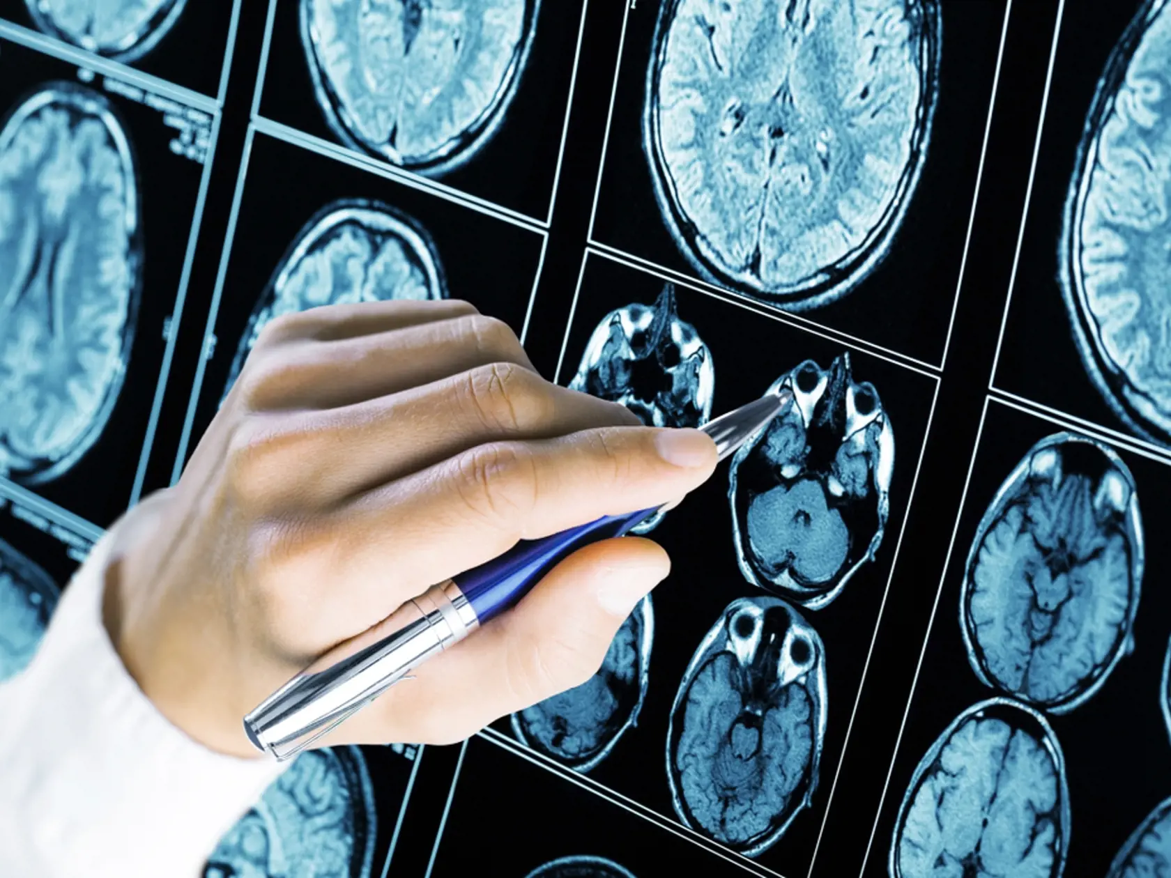 Zahraničným vedcom sa podarilo zistiť, čo vidia a cítia ľudia počas klinickej smrti. Taktiež zistili, že niektorí pacienti sú aj hodinu po zástave srdca stále funkčný a je ich možné oživiť.