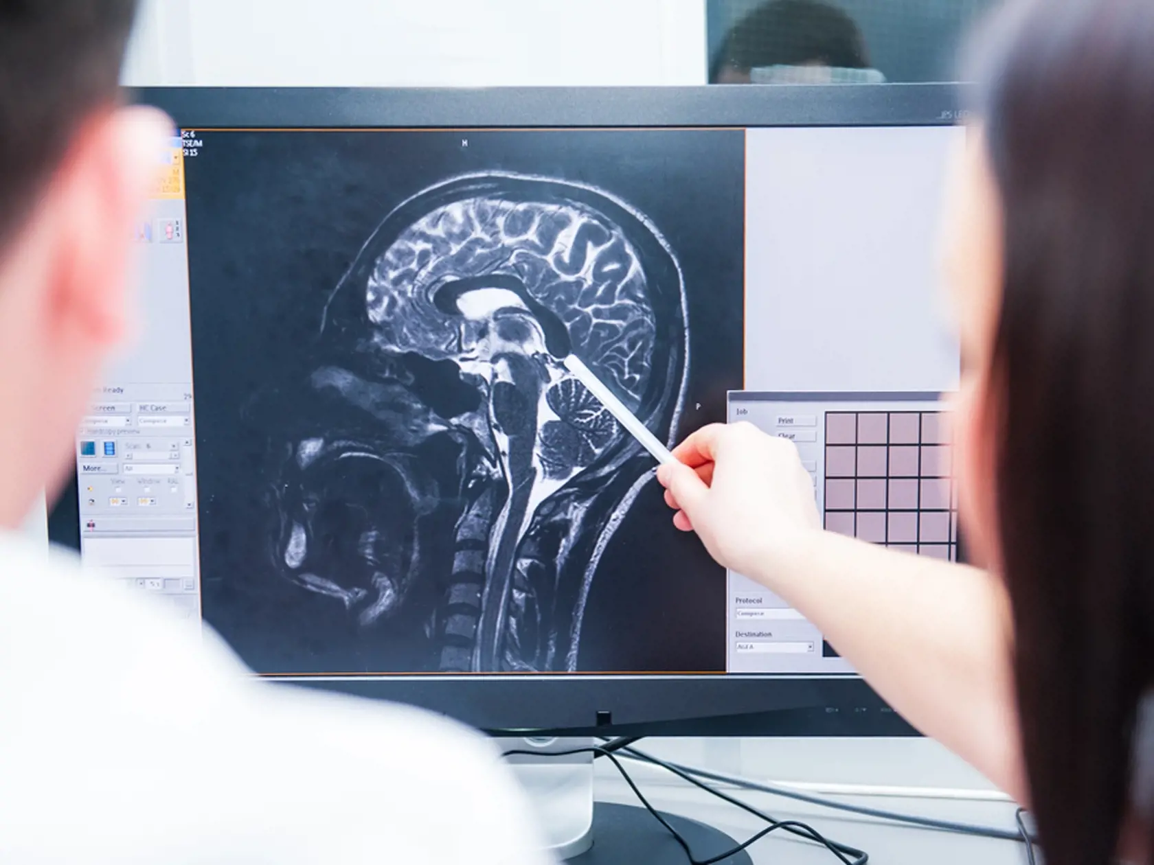 Zahraničným vedcom sa podarilo zistiť, čo vidia a cítia ľudia počas klinickej smrti. Taktiež zistili, že niektorí pacienti sú aj hodinu po zástave srdca stále funkčný a je ich možné oživiť.