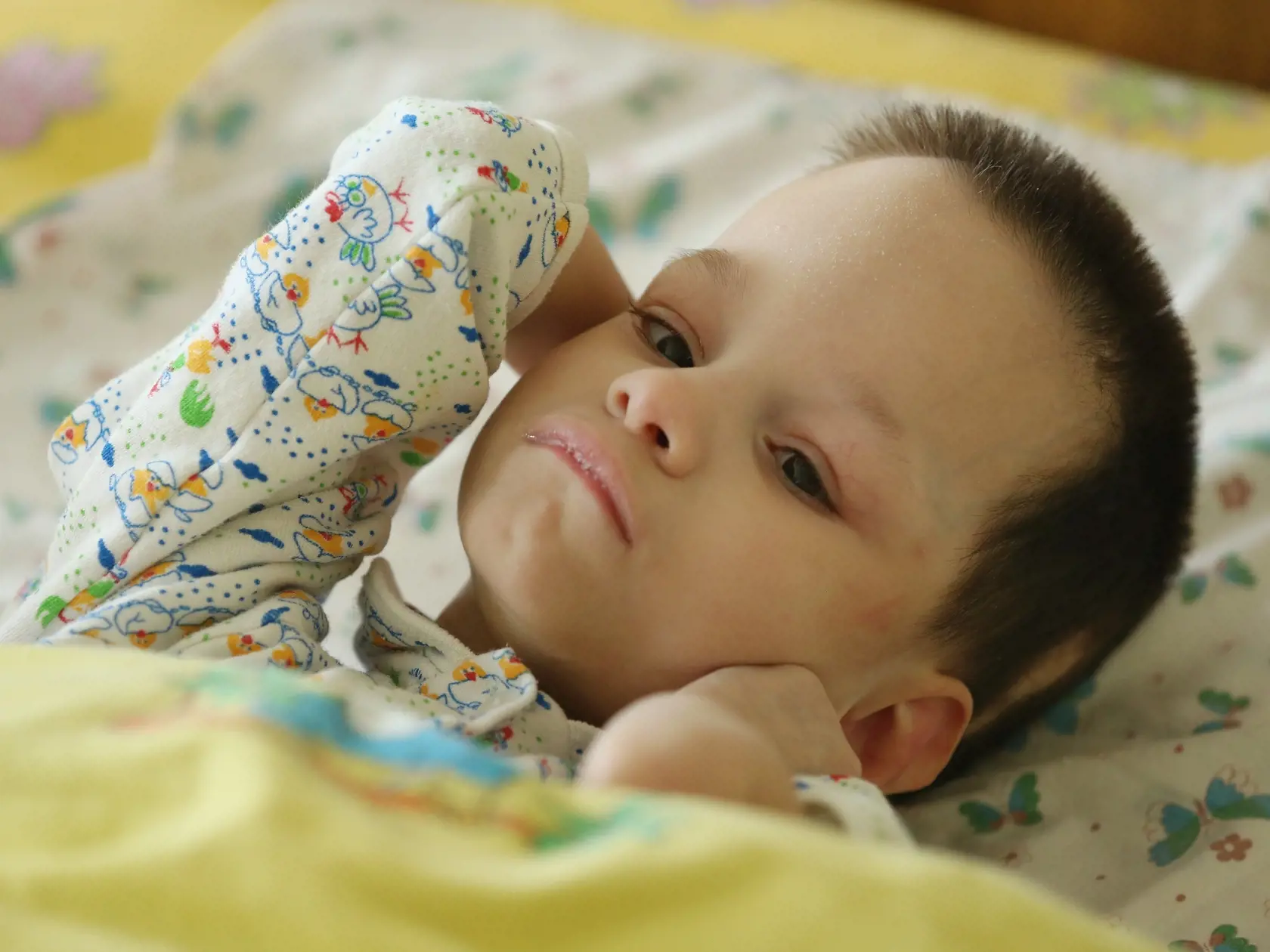 MINSK, BELARUS - APRIL 02:  Karina, 5, lies in her bed at Children's House Number 1, a facility for abandoned young children with severe disabilities on March 31, 2016 in Minsk, Belarus. Karina is diagnosed with Dandy-Walker syndrome, a congenital birth malformation of the brain, and her symptoms include an enlarged skull, deformed limbs and disfunctional cognitive and motor skills. Though a report released by the United Nations Scientific Committee on the Effects of Radiation (UNSCEAR) claims t