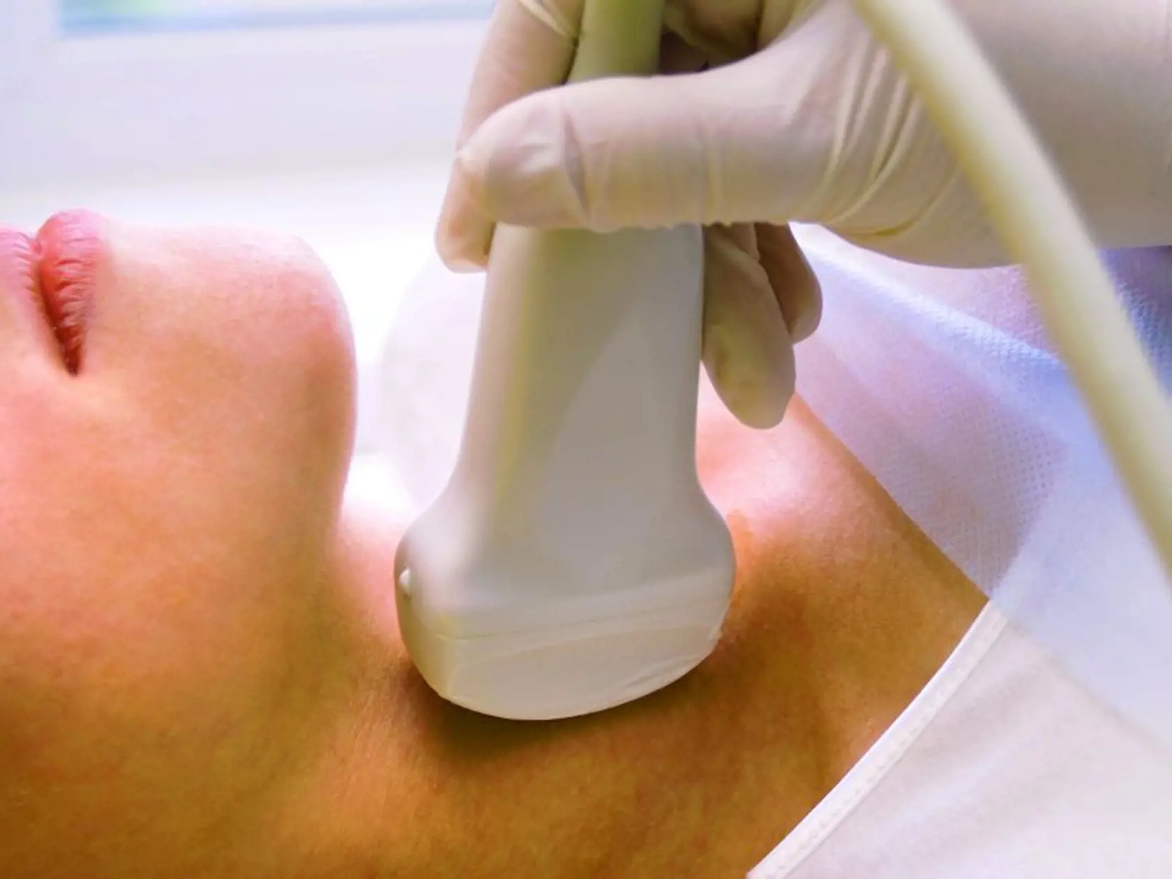Až 80 % pacientov s rakovinou lymfatických uzlín má nádej na úplné vyliečenie, pri včasnej diagnostike môže percento vyliečených vzrásť až na 95 %.