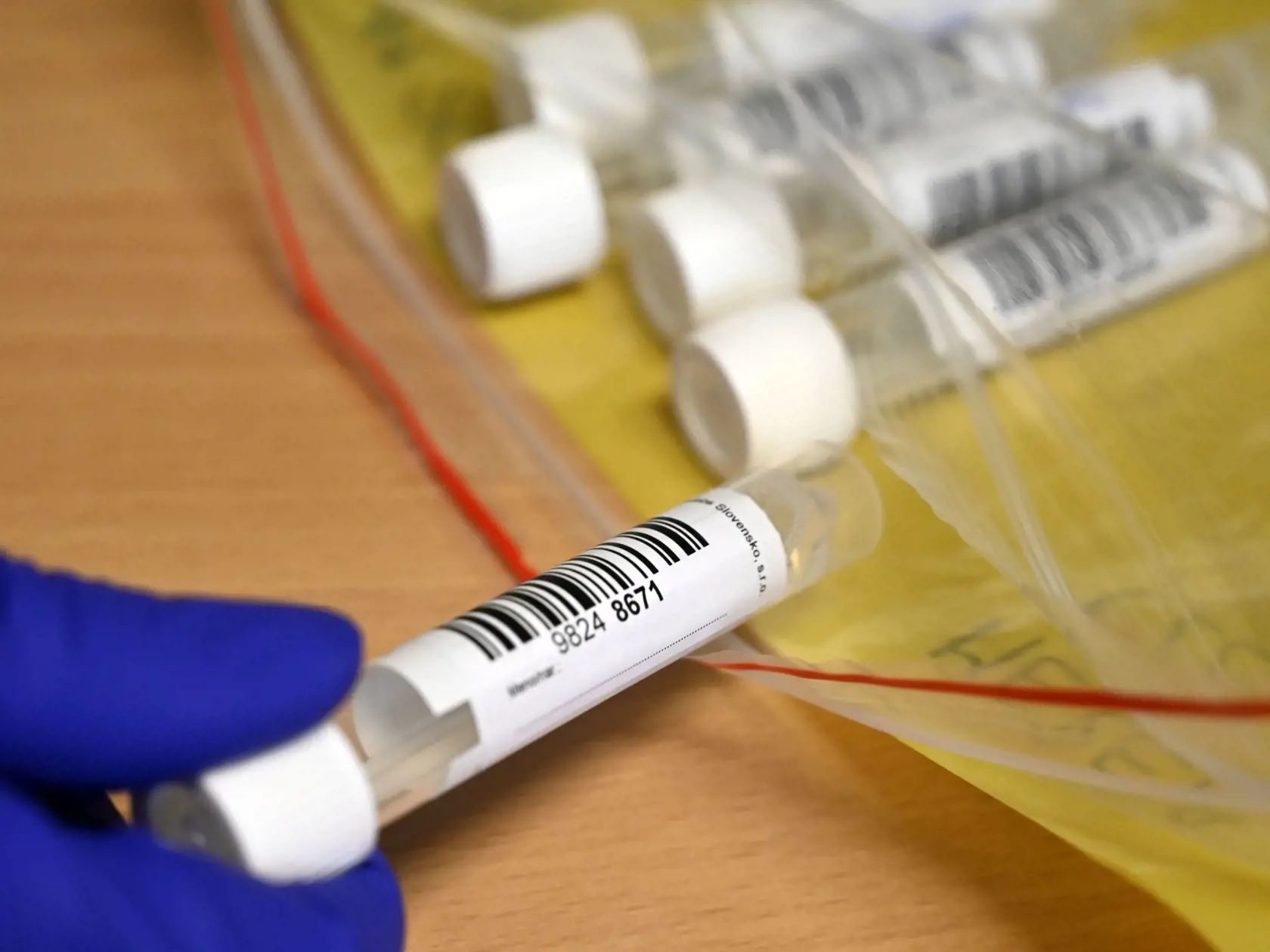 Na snímke testovanie PCR testami na prítomnosť ochorenia COVID-19 v rómskej osade v Trebišove 26. novembra 2021. FOTO TASR - Roman Hanc