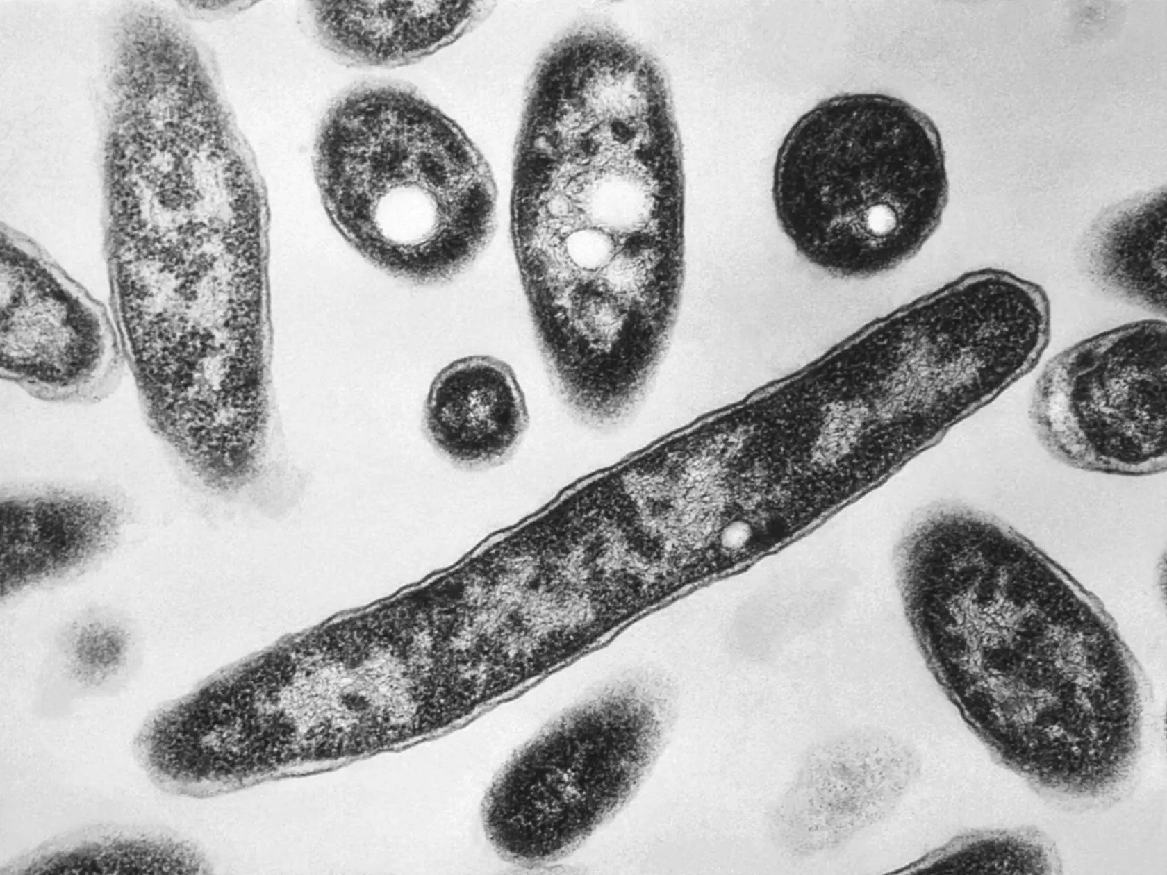 Snímka z elektrónového mikroskopu z roku 1978, ktorý sprístupnili Centrá pre kontrolu a prevenciu chorôb, ukazuje baktérie Legionella pneumophila, ktoré sú zodpovedné za spôsobenie pľúcneho ochorenia legionárska choroba.
