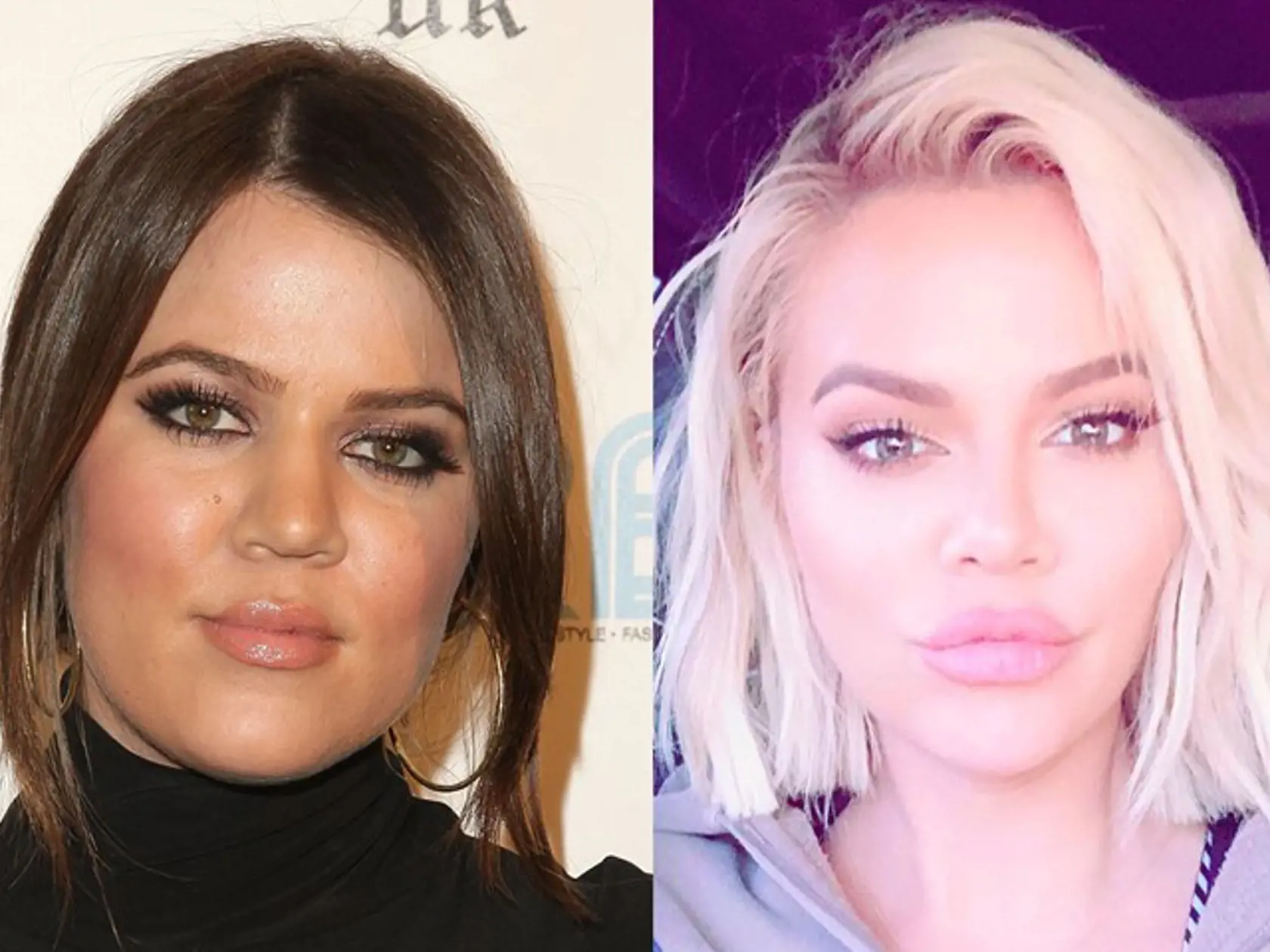 Podľa mnohých sa však Khloe na seba už vôbec nepodobá, plastiky však ďalej popiera, čo sa fanúšikom prestáva páčiť.