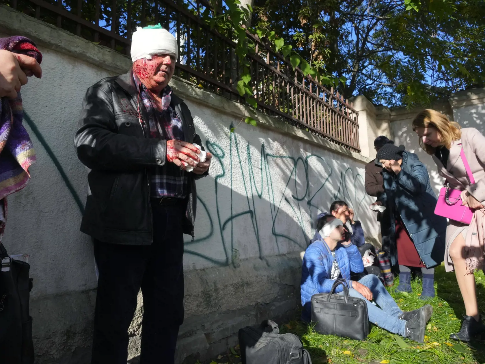 Na snímke zranení ľudia počas lekárskeho ošetrenia po ruskom ostreľovaní v Kyjeve 10. októbra 2022. V dôsledku raketového útoku na centrum Kyjeva z pondelka rána došlo k obetiam na životoch i zraneniam ľudí.  Poradca ukrajinského ministra vnútra Rostyslav Smirnov podľa RFE/RL uviedol, že útok na Ševčenkov mestský obvod v Kyjeve si vyžiadal osem obetí na životoch a 24 ranených.