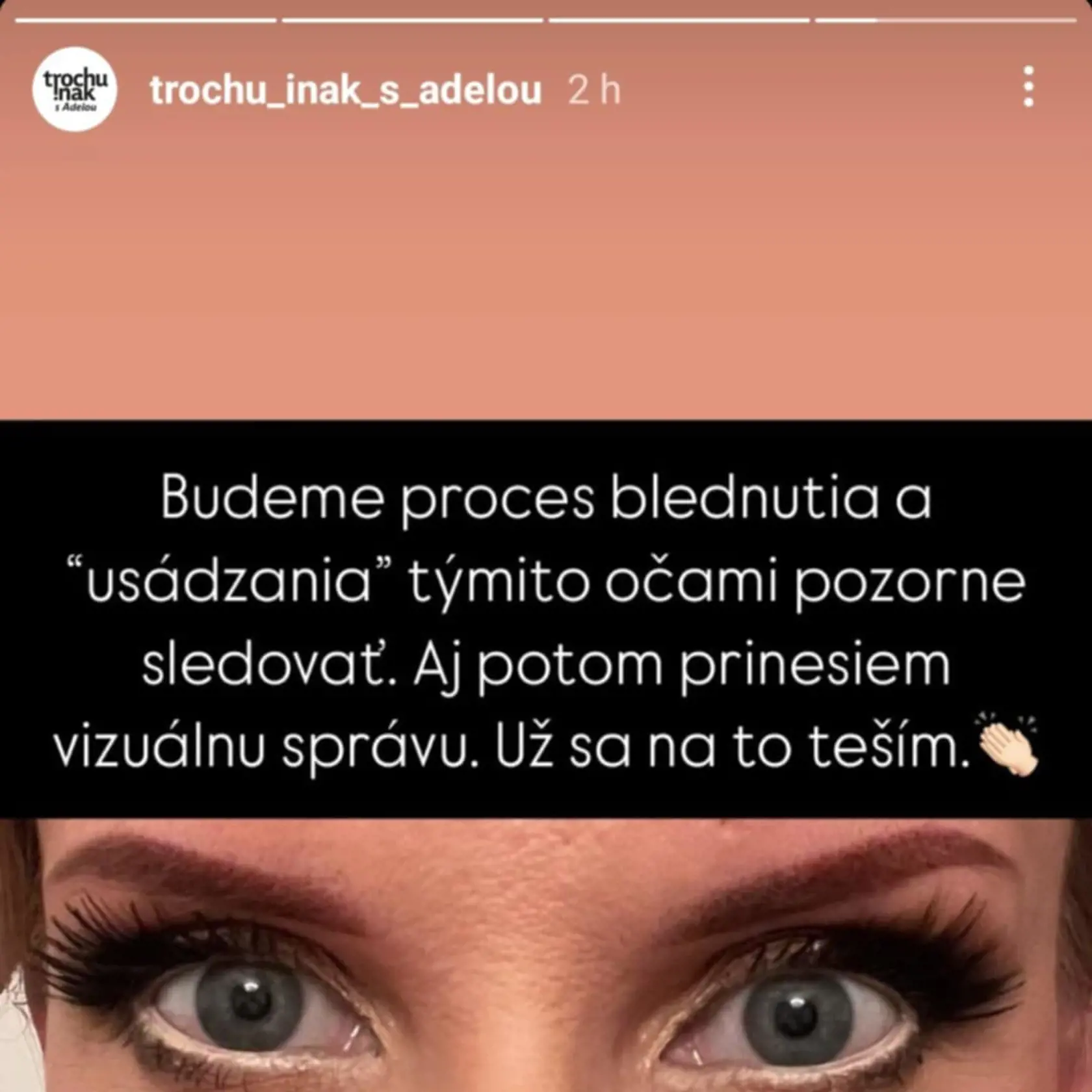 Adela Vinczeová má nové obočie.