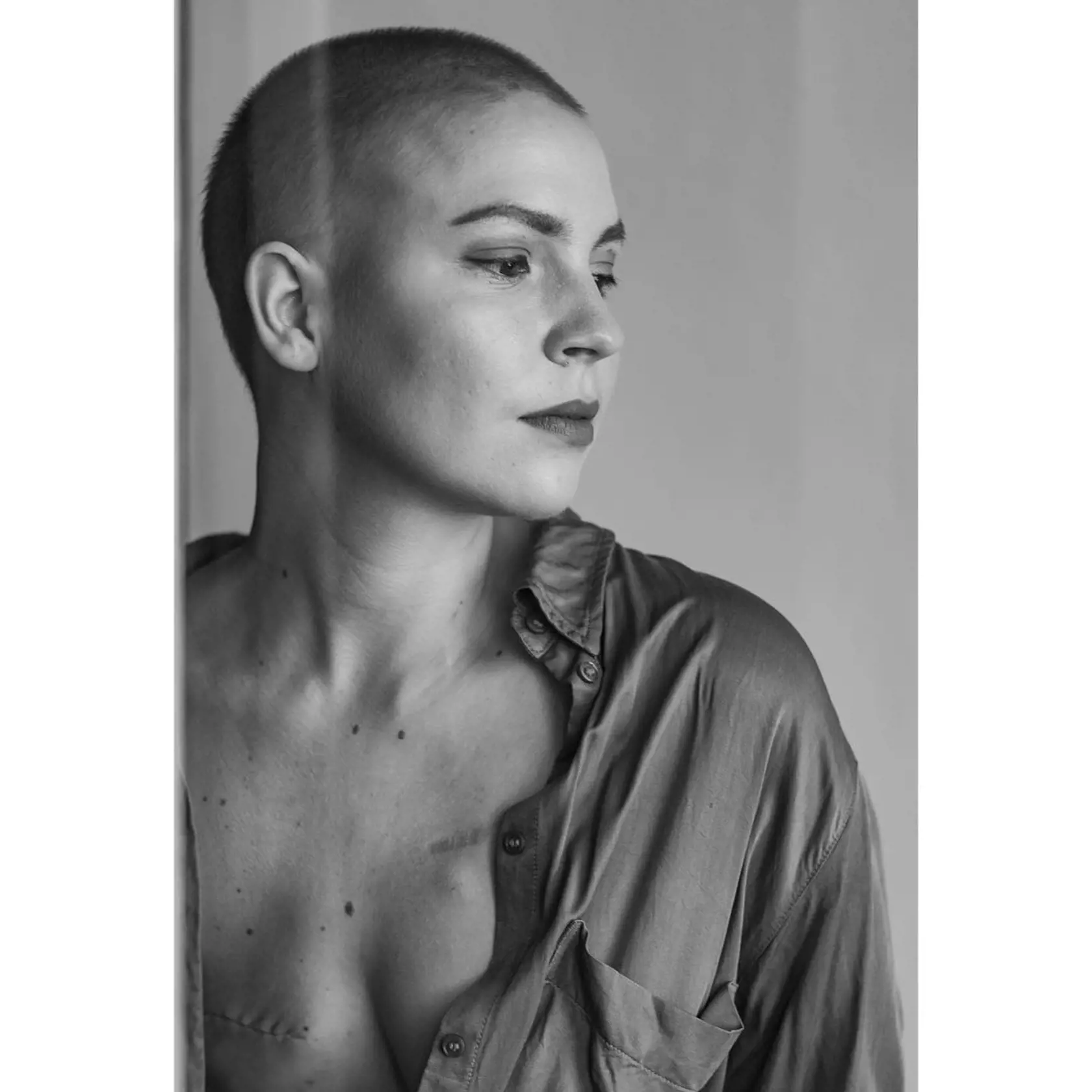 Patrícia Janečková zverejnila mesiac po operácii pŕs svoju jazvu.