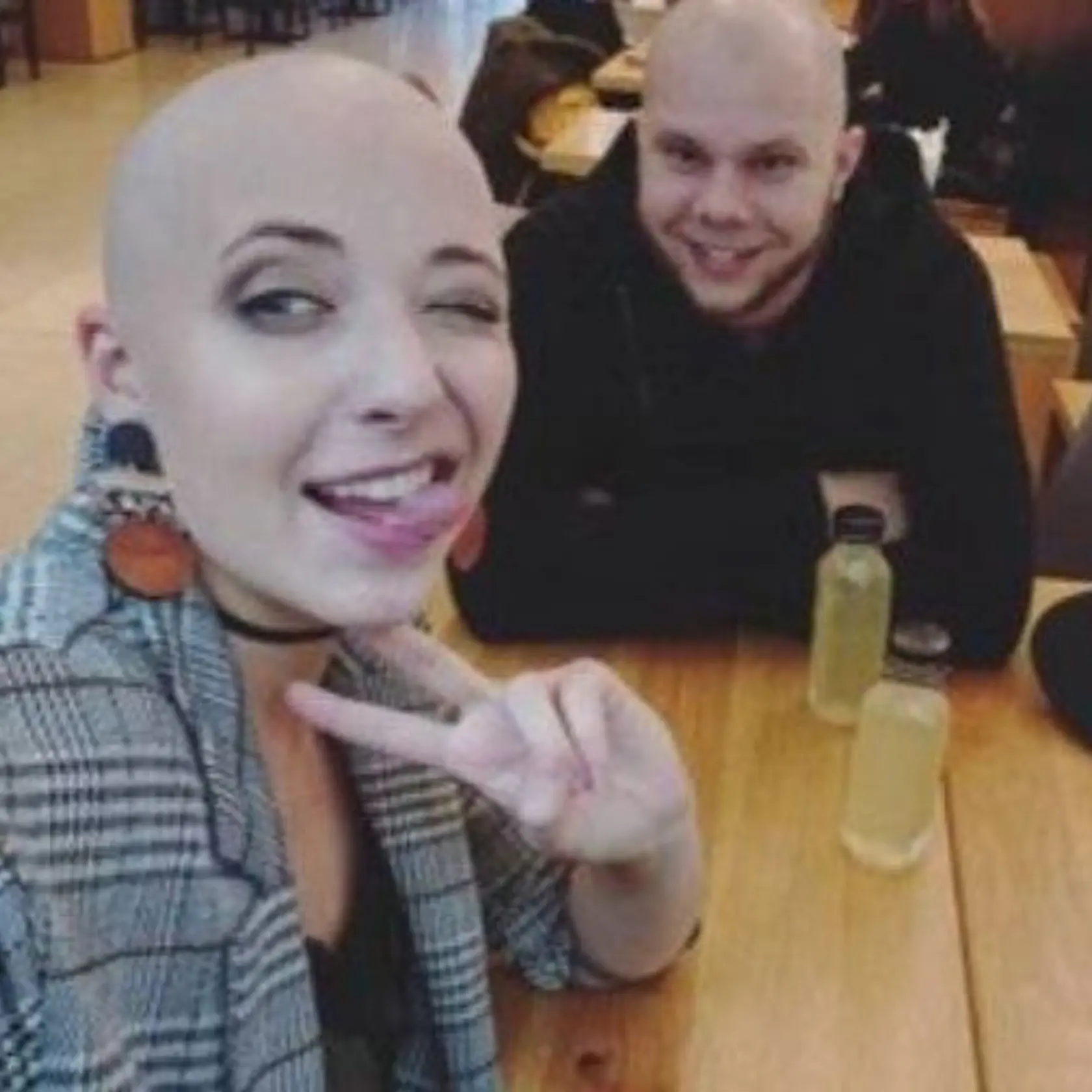 Anička Slováčková (†29) kvôli chemoterapii prišla o vlasy.