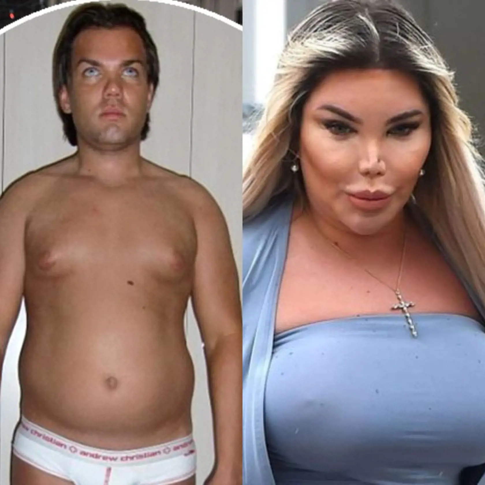 Keď Rodrigo Alves (36) začal s plastickými operáciami, tvrdil, že chce zo seba spraviť živého Kena.