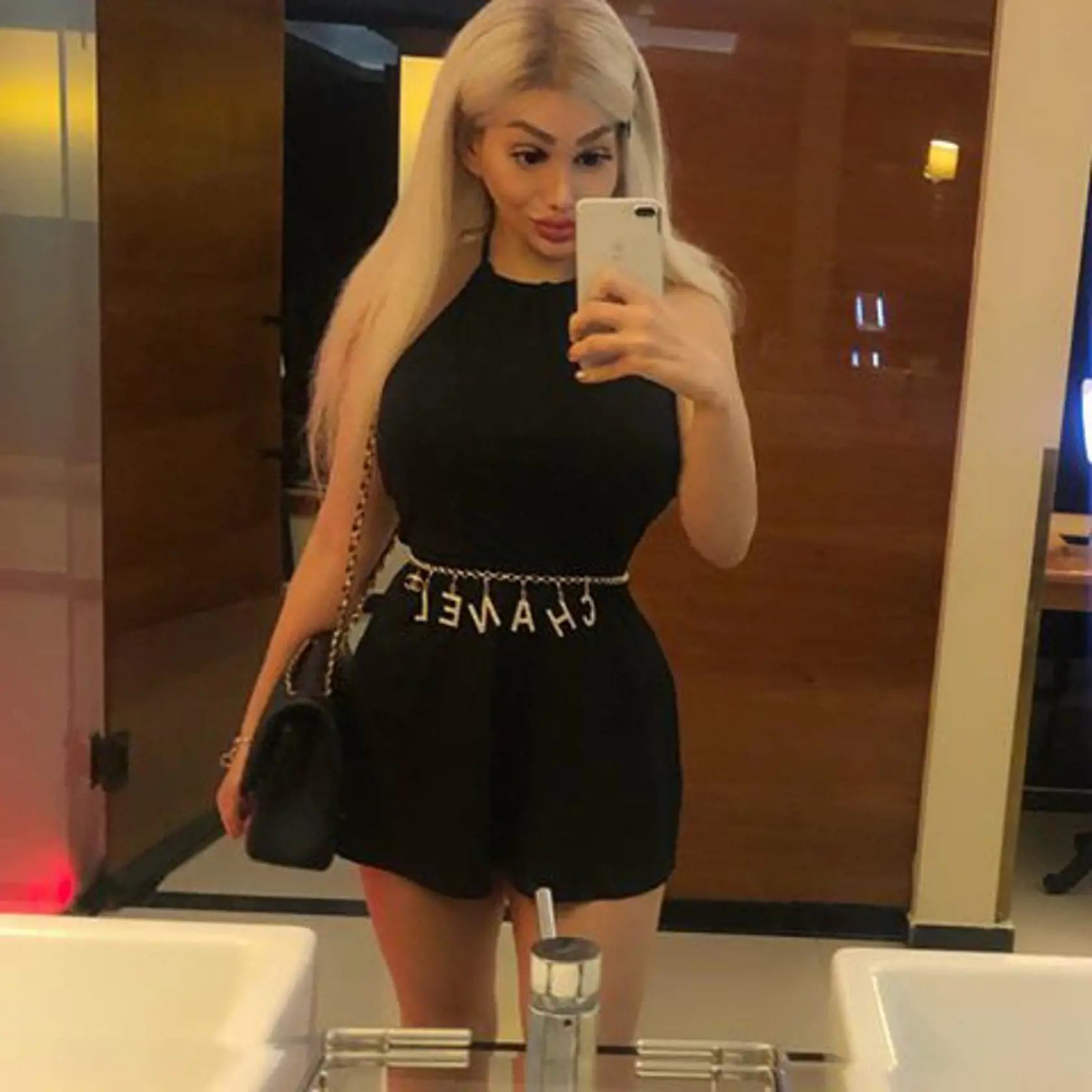 Živou Barbie sa môže pochváliť už aj Maďarsko. Webová modelka Barbara Luna Sipos (22) z Budapešti bola na svojej prvej operácii v 17 rokoch, kedy si nechala zväčšiť poprsie a od tej doby je na plastikách závislá.