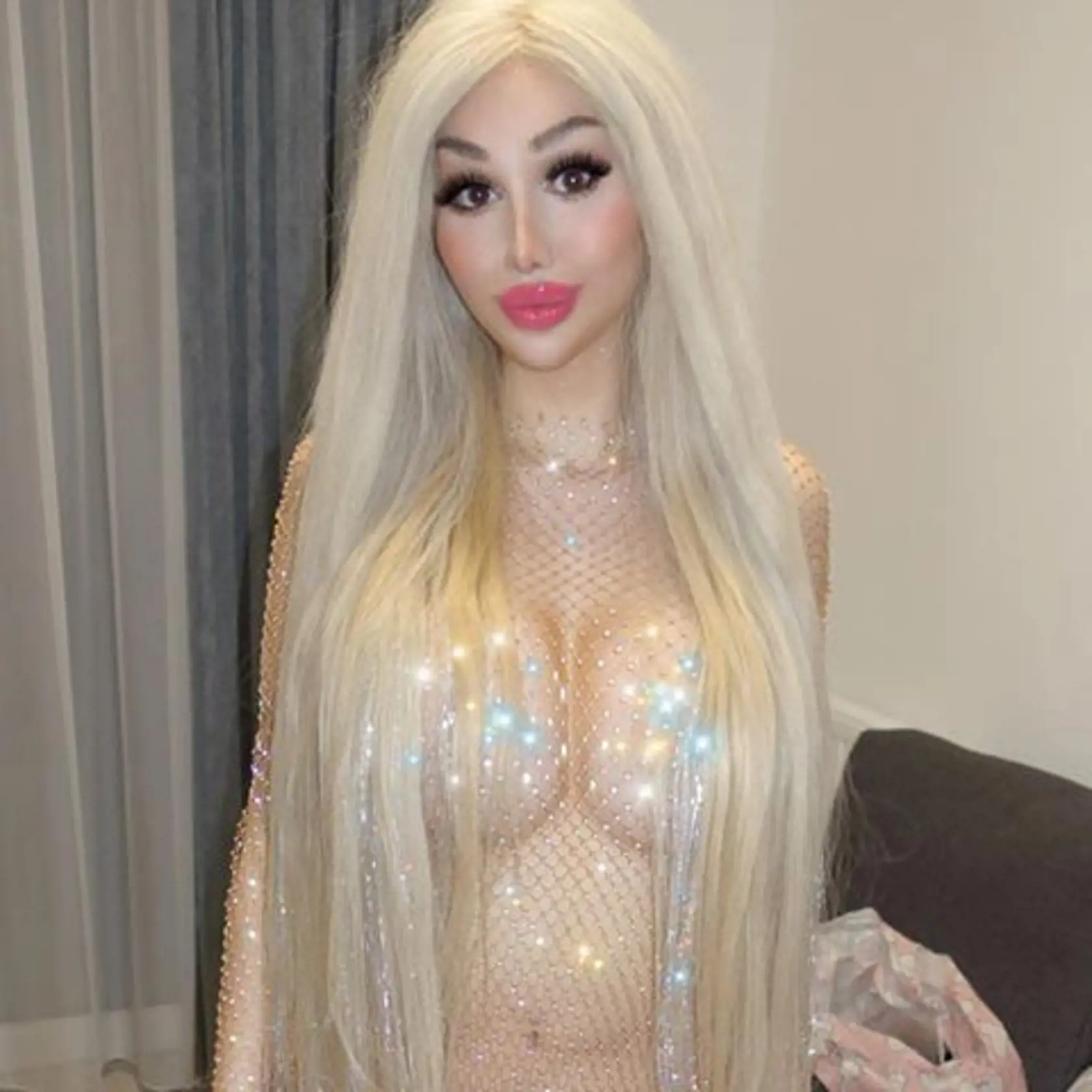 Živou Barbie sa môže pochváliť už aj Maďarsko. Webová modelka Barbara Luna Sipos (22) z Budapešti bola na svojej prvej operácii v 17 rokoch, kedy si nechala zväčšiť poprsie a od tej doby je na plastikách závislá.