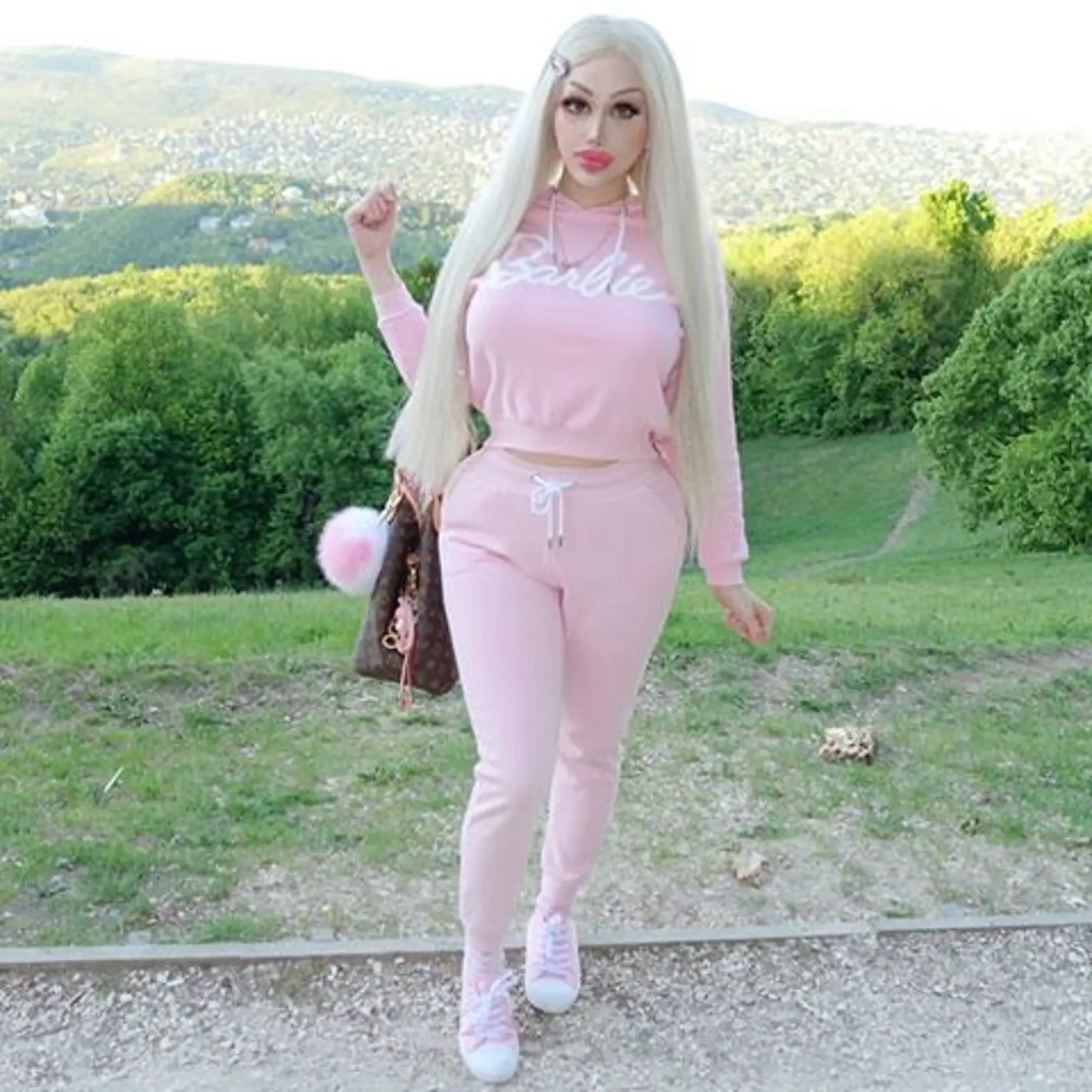 Živou Barbie sa môže pochváliť už aj Maďarsko. Webová modelka Barbara Luna Sipos (22) z Budapešti bola na svojej prvej operácii v 17 rokoch, kedy si nechala zväčšiť poprsie a od tej doby je na plastikách závislá.