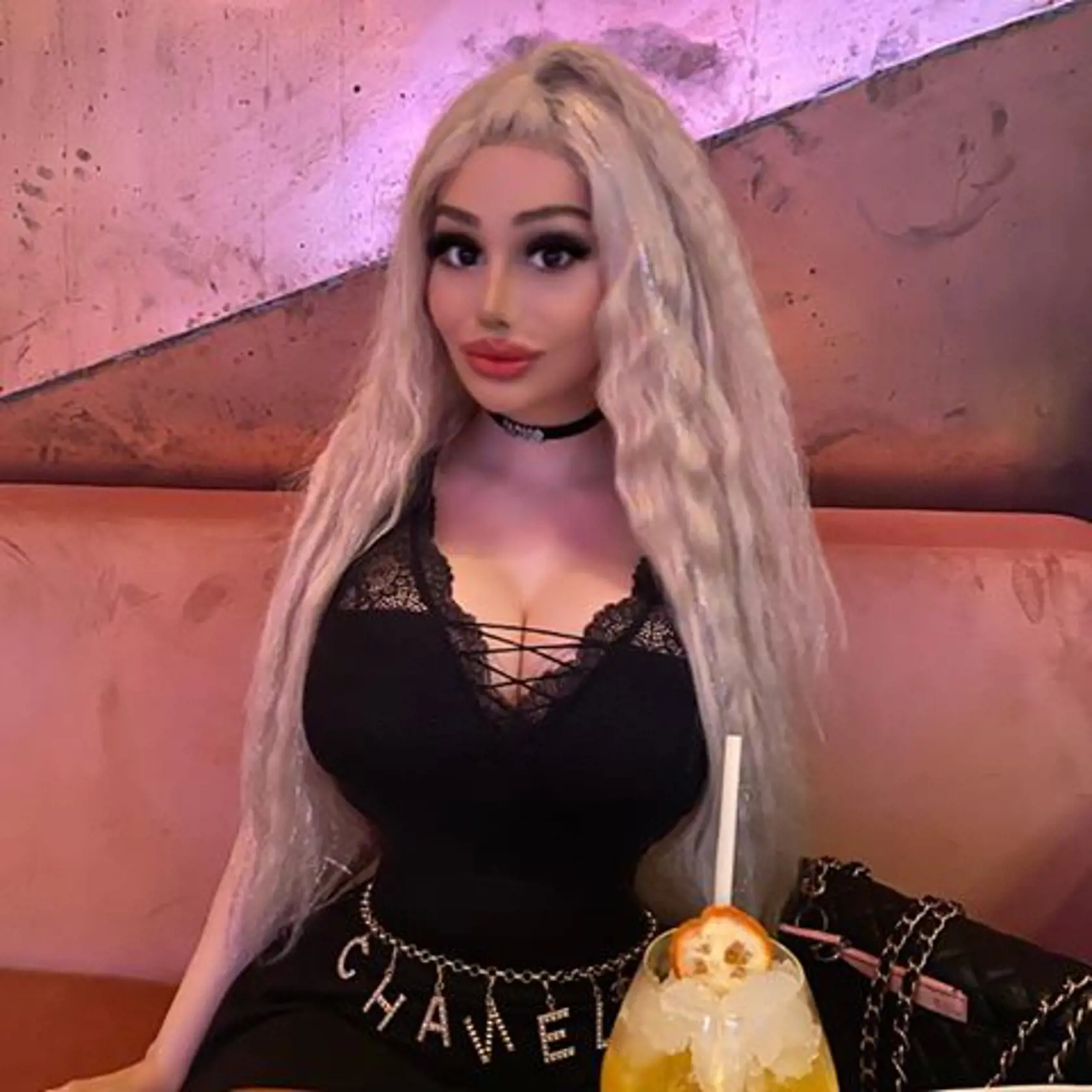 Živou Barbie sa môže pochváliť už aj Maďarsko. Webová modelka Barbara Luna Sipos (22) z Budapešti bola na svojej prvej operácii v 17 rokoch, kedy si nechala zväčšiť poprsie a od tej doby je na plastikách závislá.