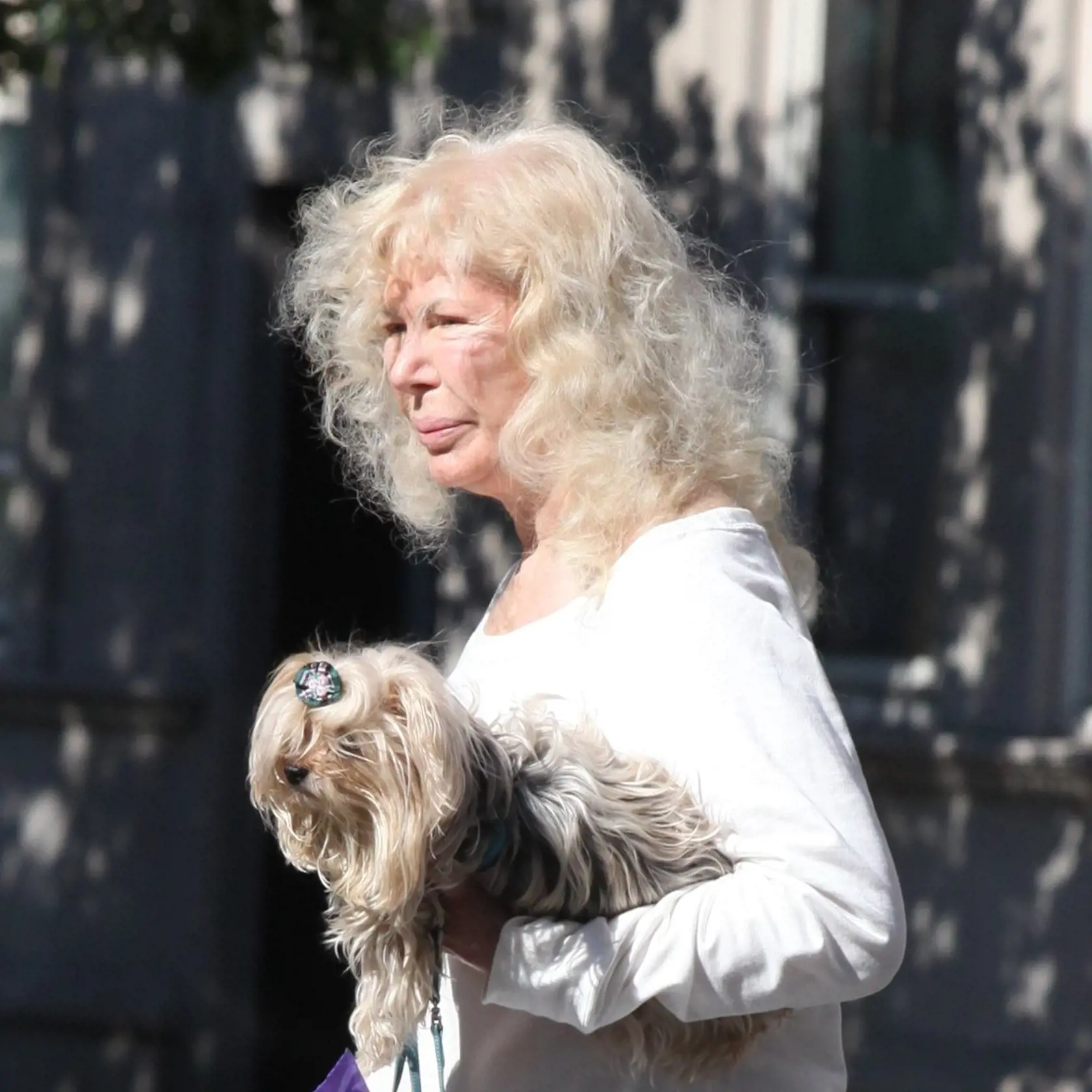 Loretta Swit časom prepadla plastickým operáciám a kozmetickým zákrokom. A ako sa dá tušiť, čoho je veľa, toho je príliš. Herečka sa o svoju krásu nakoniec nedobrovoľne pripravila sama a zmenila sa takmer na nepoznanie.