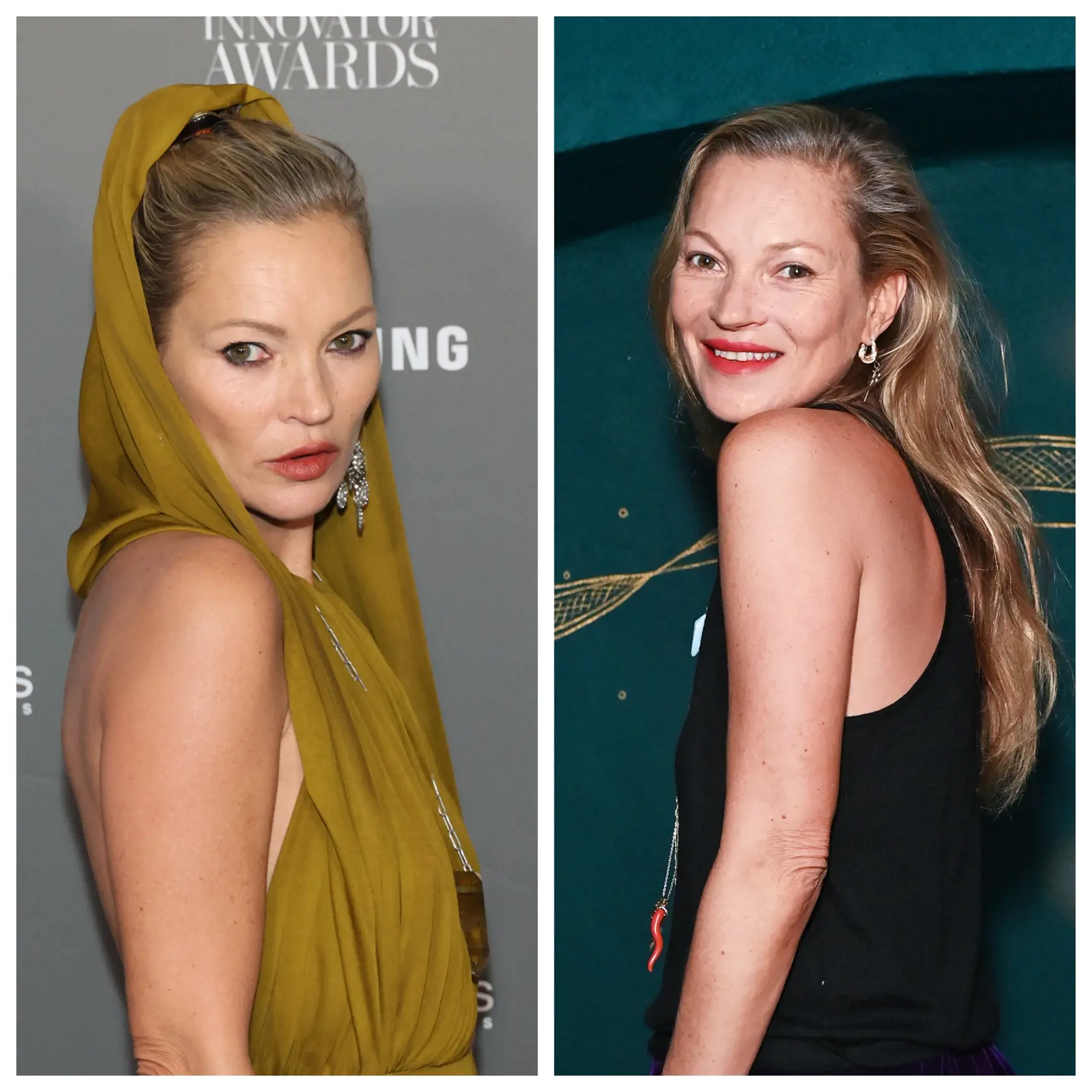 Kate Moss sa v poslednej dobe zmenili. Jej tvár vyzerá inak.