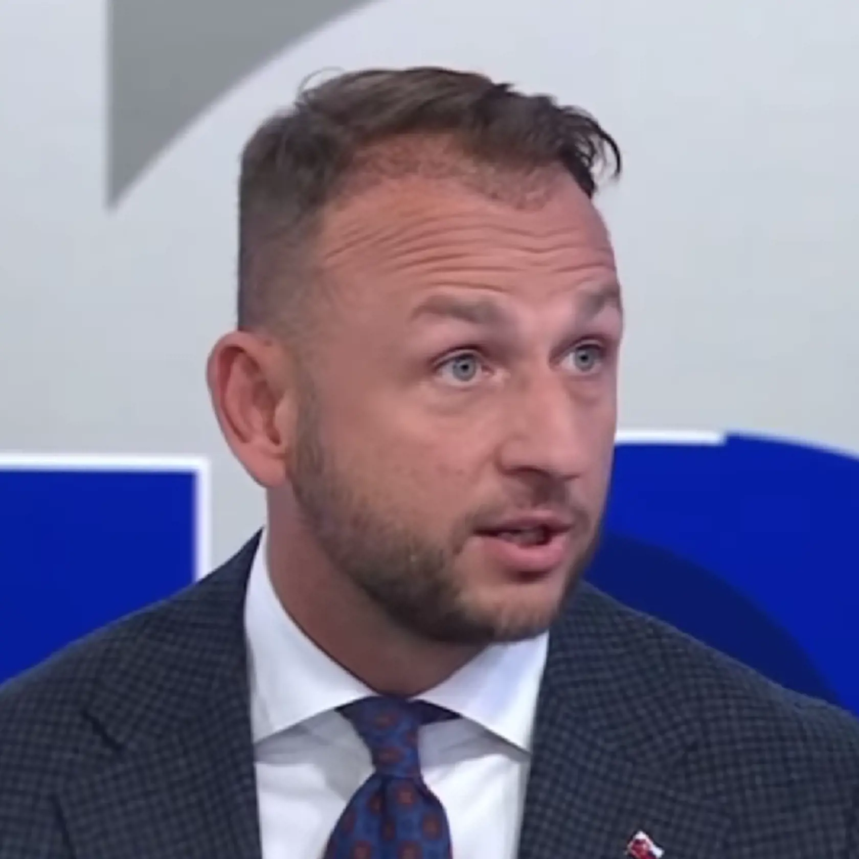 EXKLUZÍVNE PRIZNANIE MATÚŠA ŠUTAJA EŠTOKA: “Vypadávanie vlasov je v našej rodine akosi geneticky dané. K tomu sa pridal stres z problémov, ktoré prichádzajú so zodpovednosťou na ministerskom poste, čo som doslova pocítil aj na vlastnej koži. Rozhodol som sa preto tento problém riešiť,“ prezradil nám minister, ktorý sa po náročnom roku rozhodol pre vlasové implantáty.