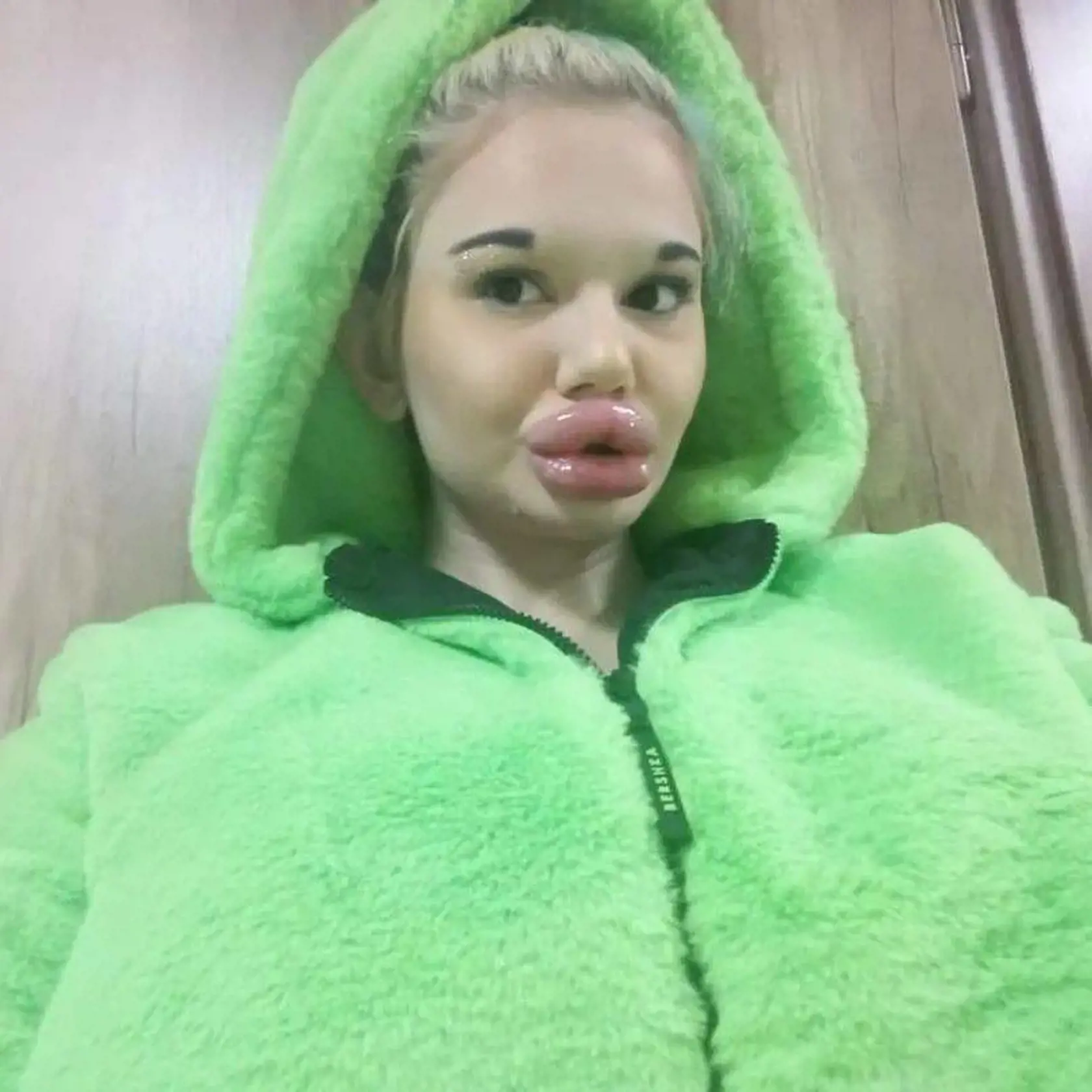 Andrea Ivanova a jej obrie ústa