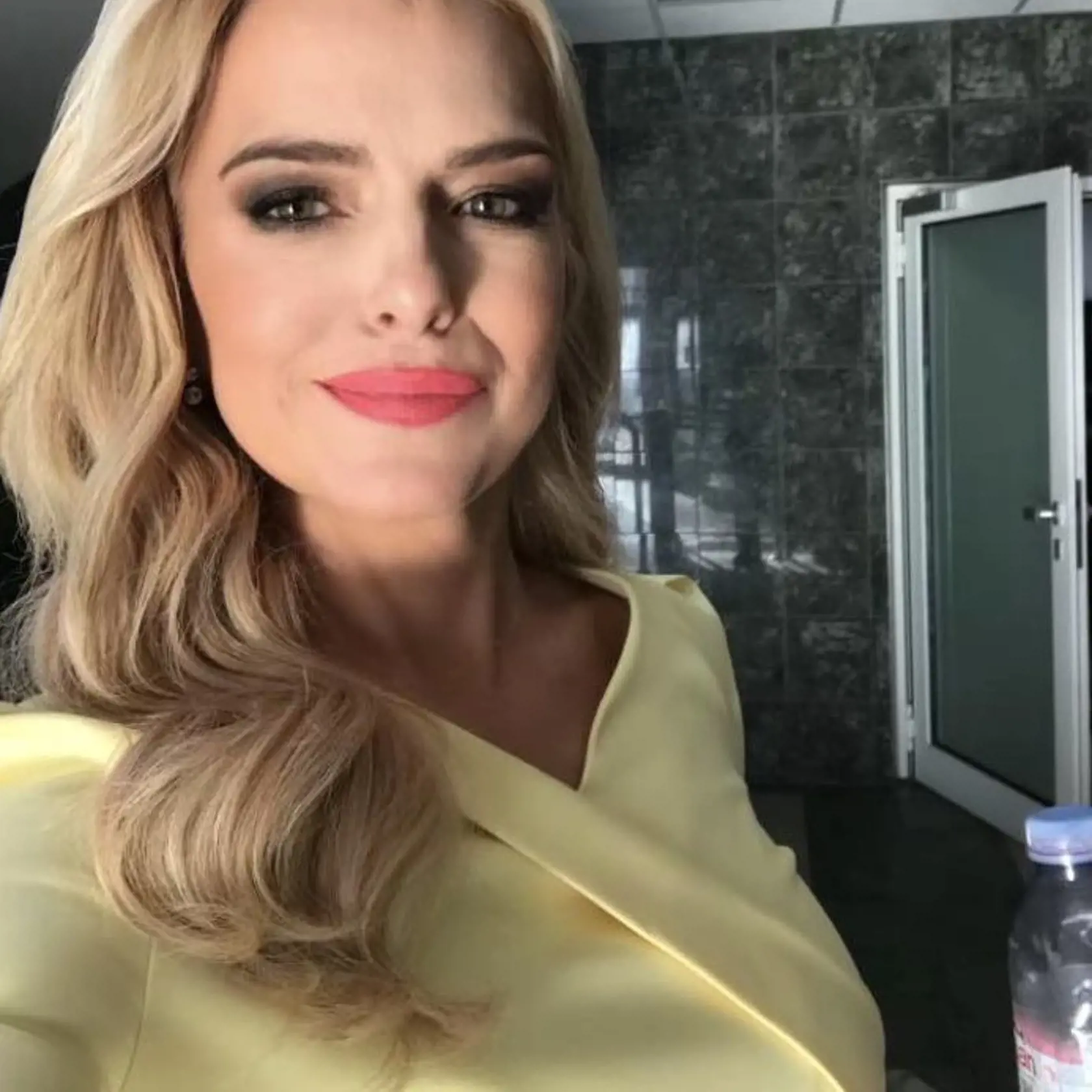 Zlatica Puškárová prehovorila o tom, či si dala napichať pery.