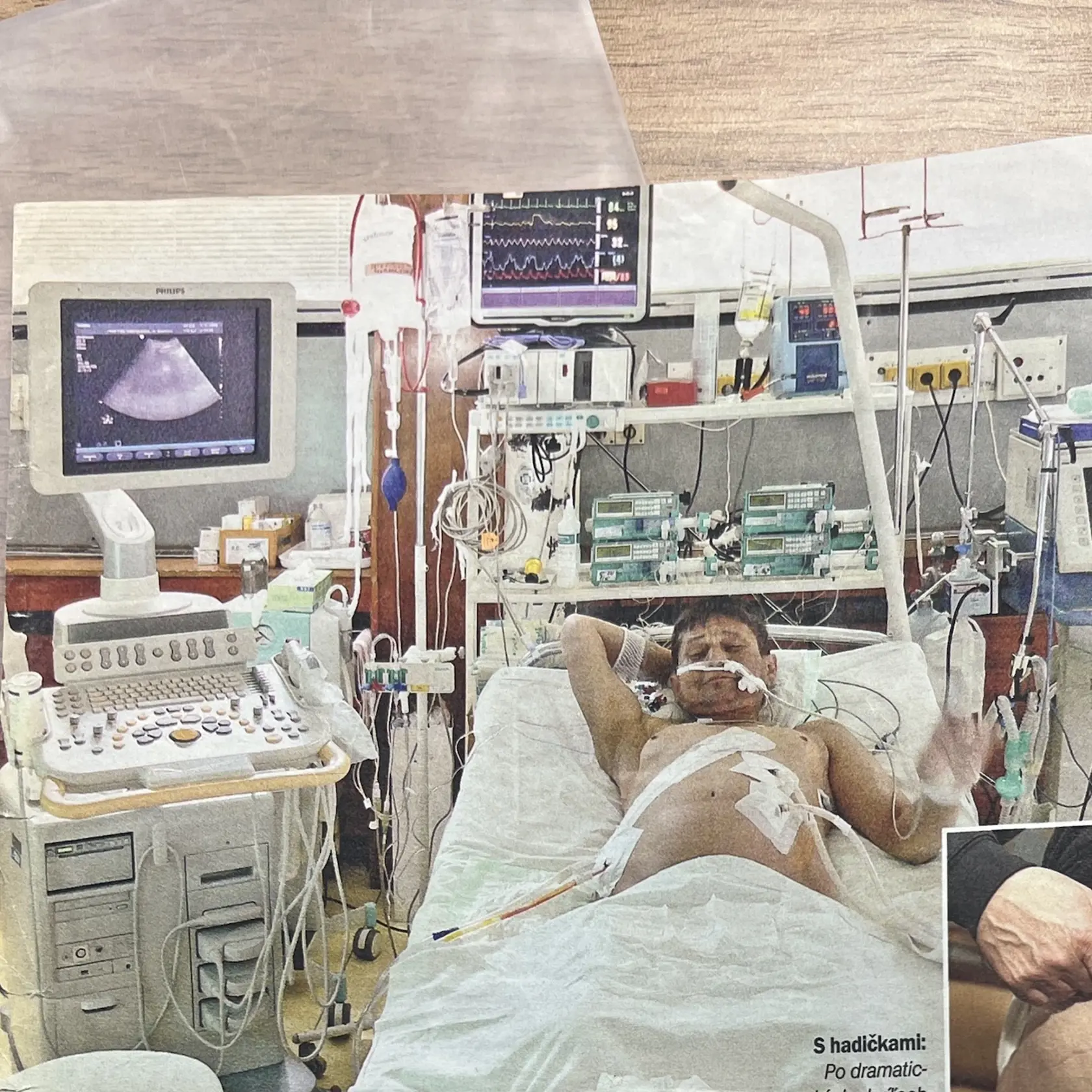 Prvýkrát Jaroslavovi transplantovali pečeň.