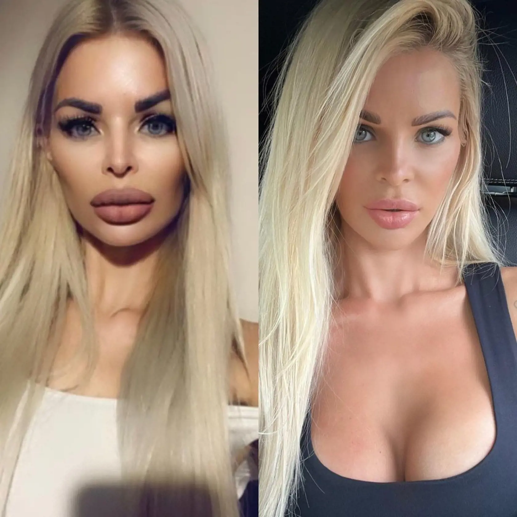 Silvia Kucherenko zverejnila fotografiu pred a po. Čo poviete na tú zmenu?