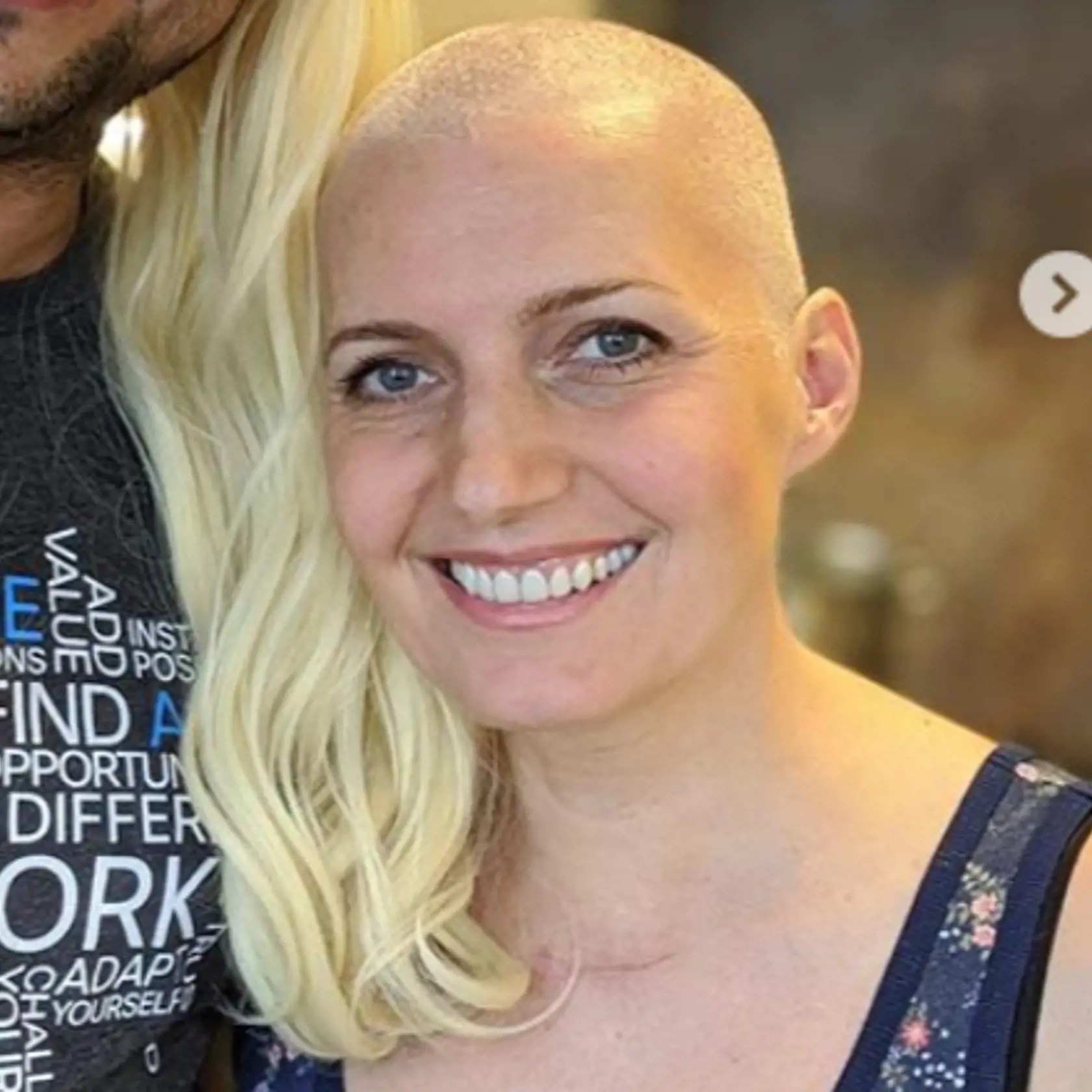 Aneta Parišková prišla o vlasy.