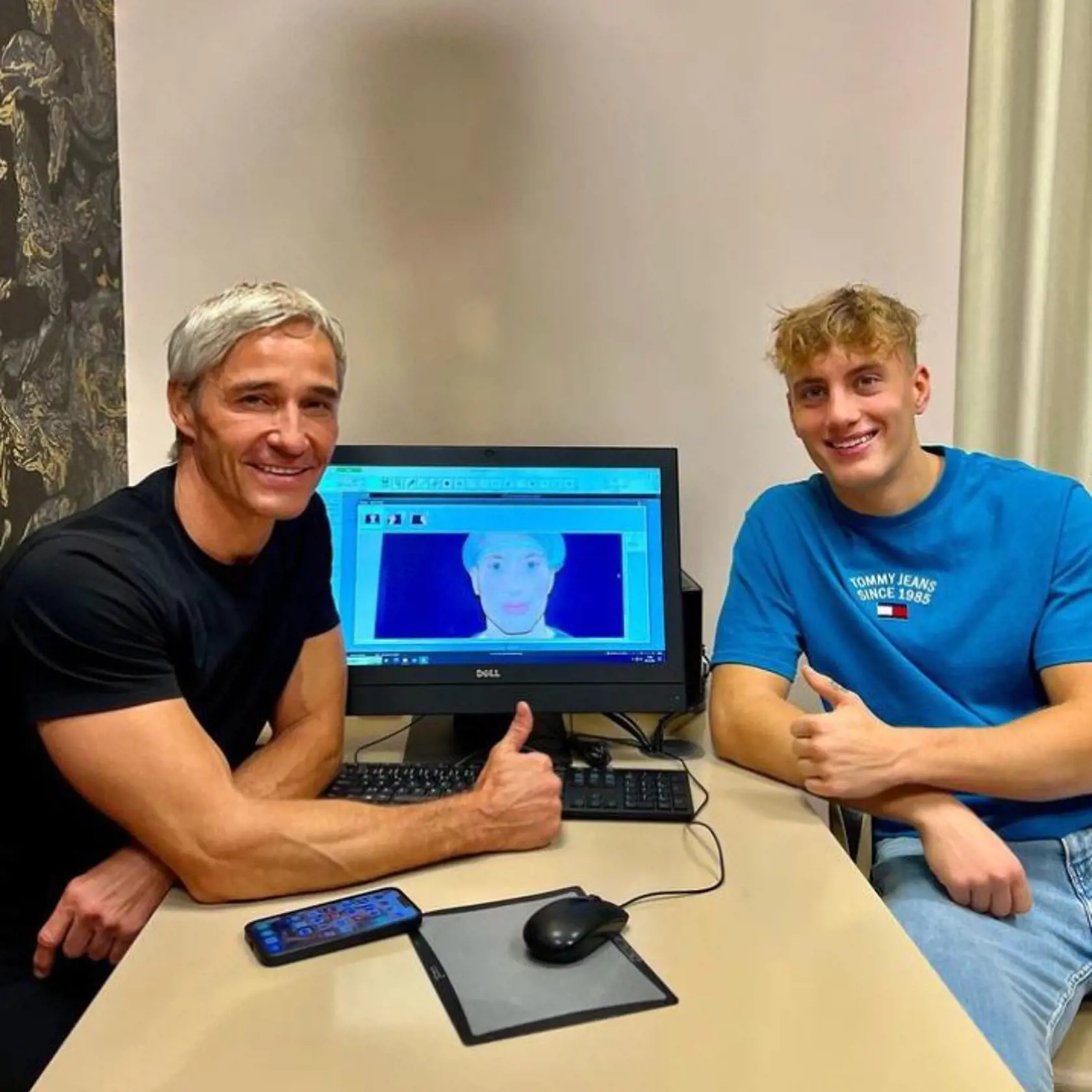 David z Love Island má za sebou rhinoplastiku. Takto vyzerá po zložení dlahy.