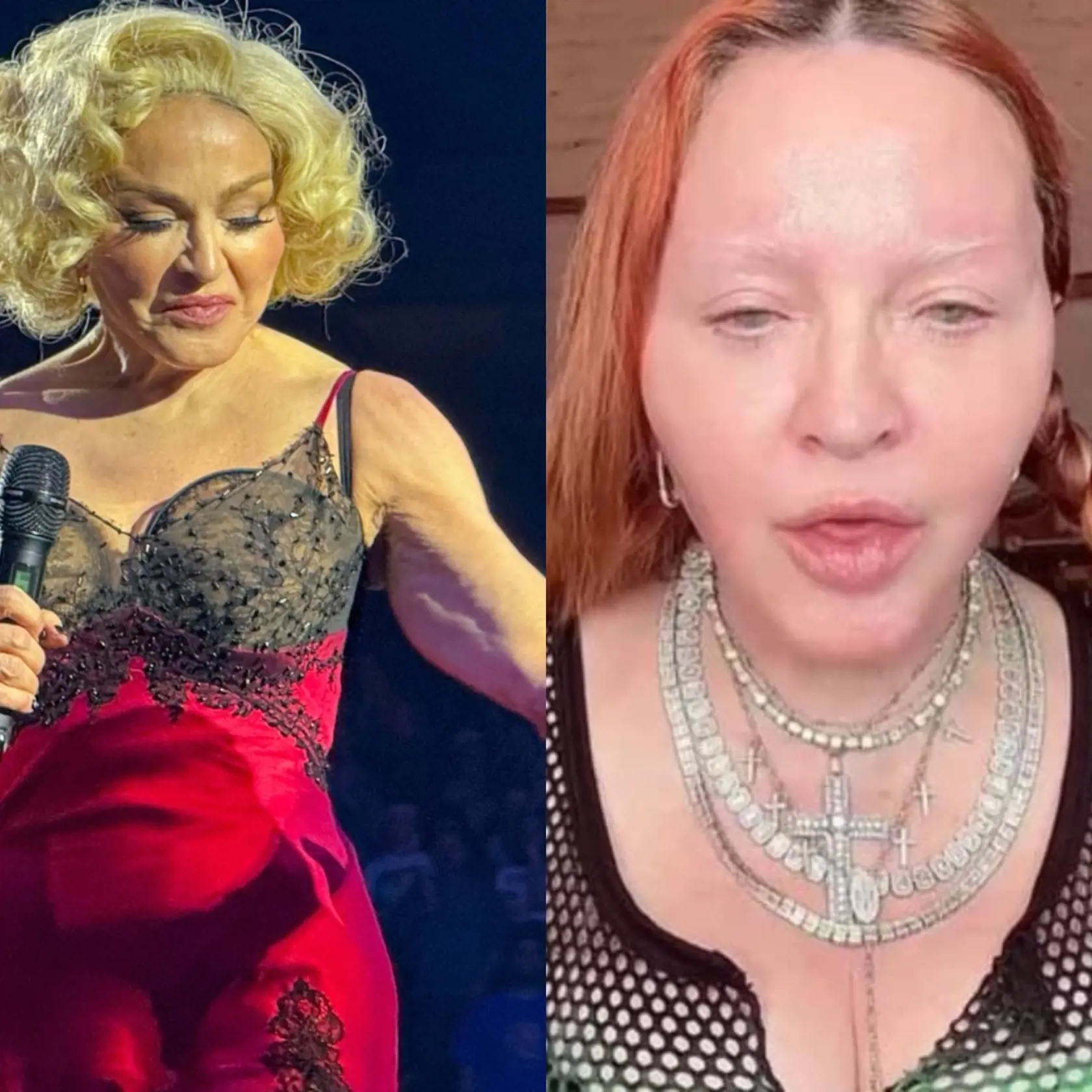 FOTO Madonna ukázala reálnu tvár: Budete zhrození! Mľandravá koža a kopa vpichov ju znetvorili