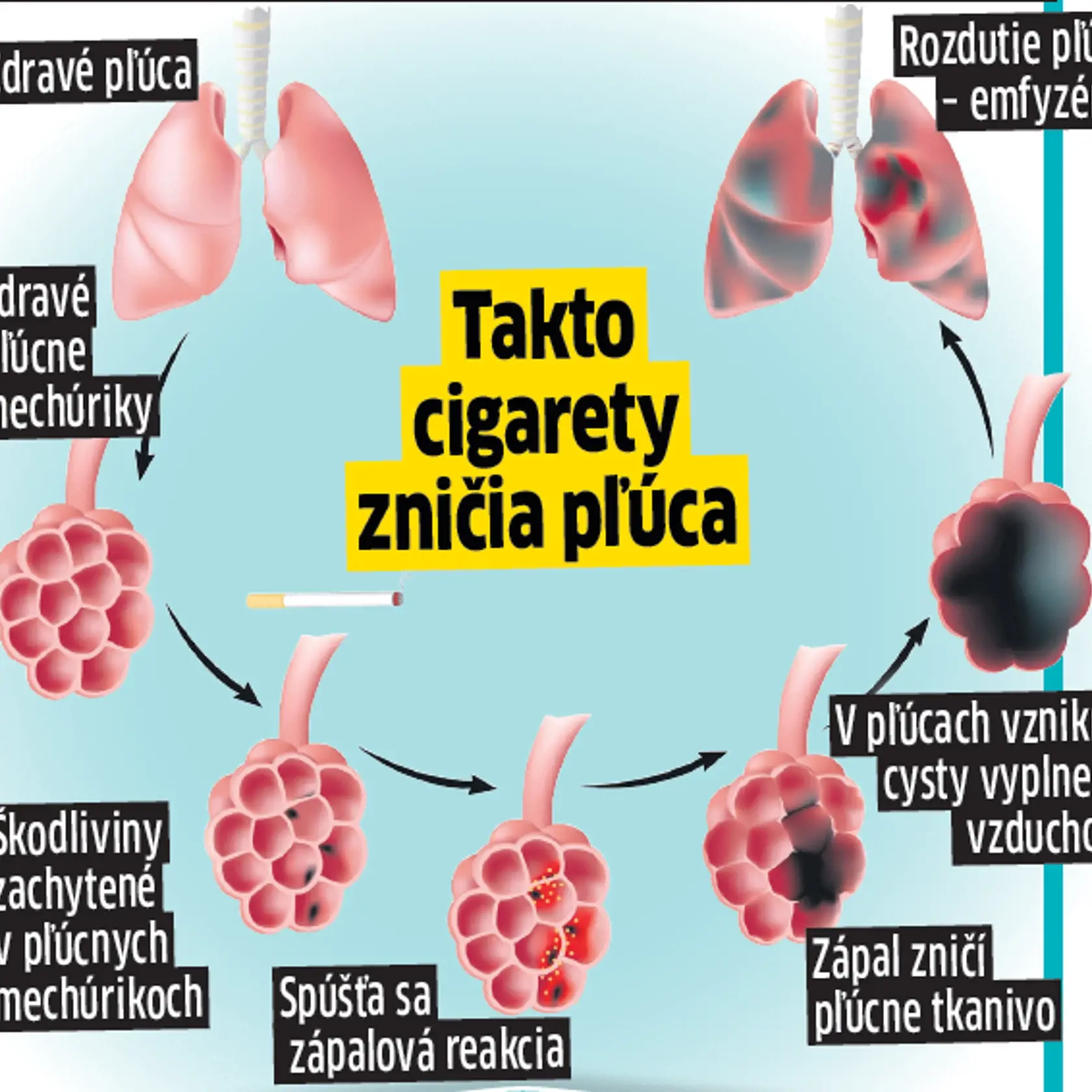 Každou cigaretou sa do tela dostáva množstvo škodlivín.