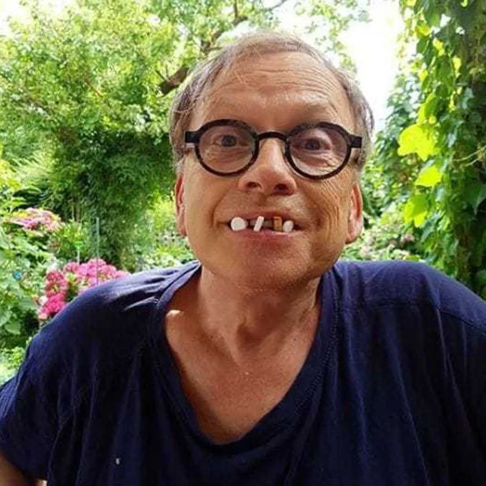 „Čo som mal dnes na raňajky? Dobrú chuť!" Napísal vtedy Ďurdiak na sociálnej sieti a vymenoval päť druhov liekov. Najzarážajúcejšie na tom však bolo, že medzi nimi spomenul aj liek, ktorý je určený na liečbu demencie, vysoký tlak a poruchy duševnej výkonnosti. No to nie je všetko...